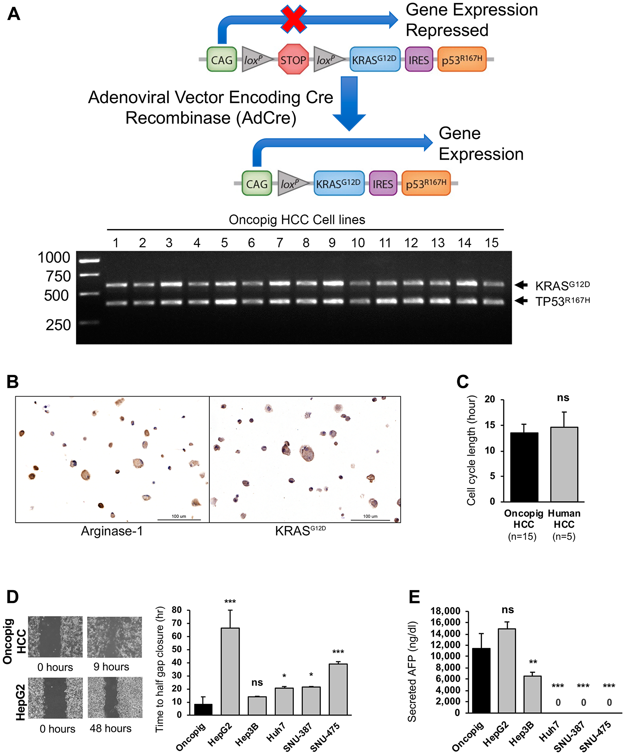 Oncopig and human HCC in vitro phenotypes
