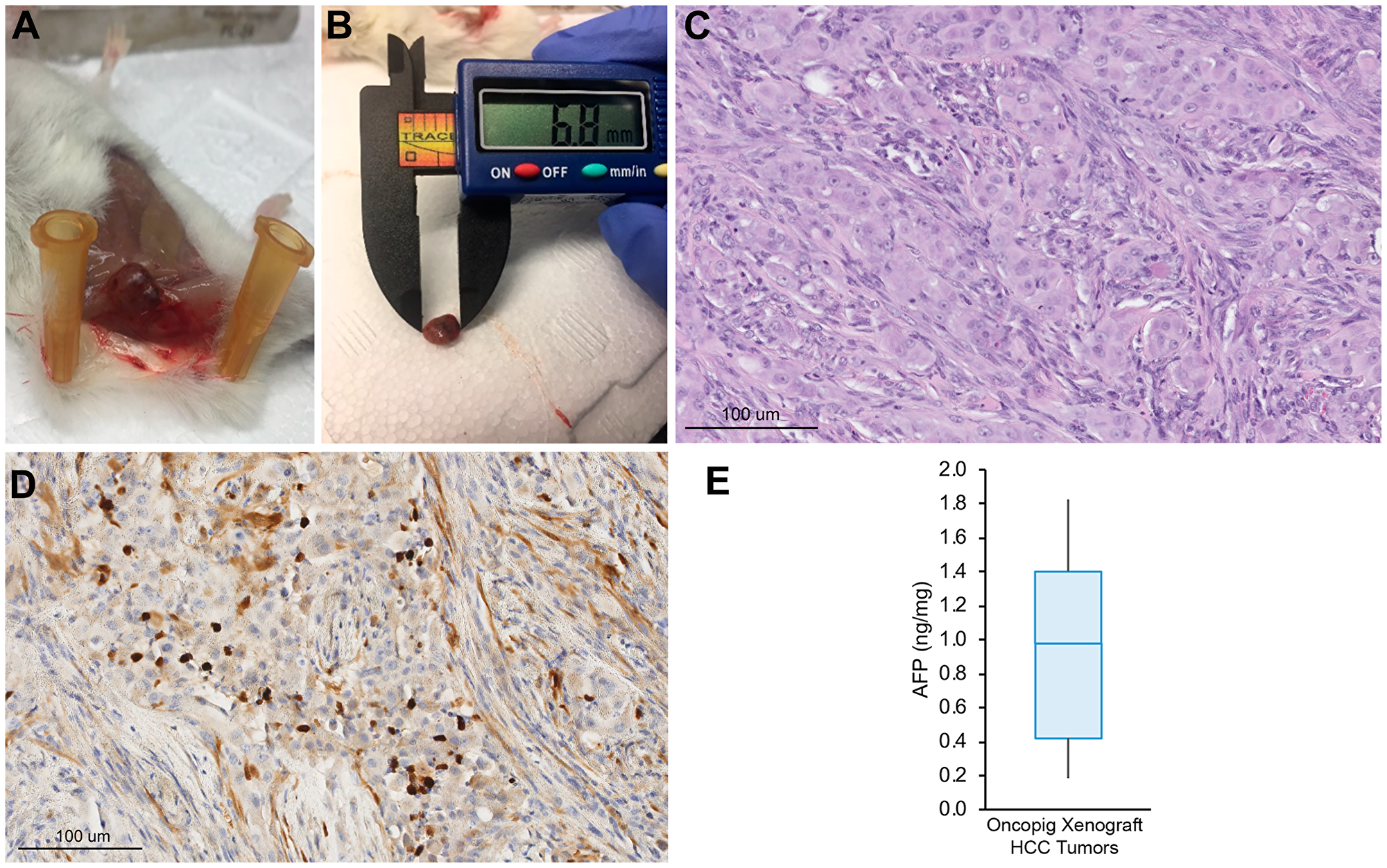 Oncopig HCC xenograft tumor development