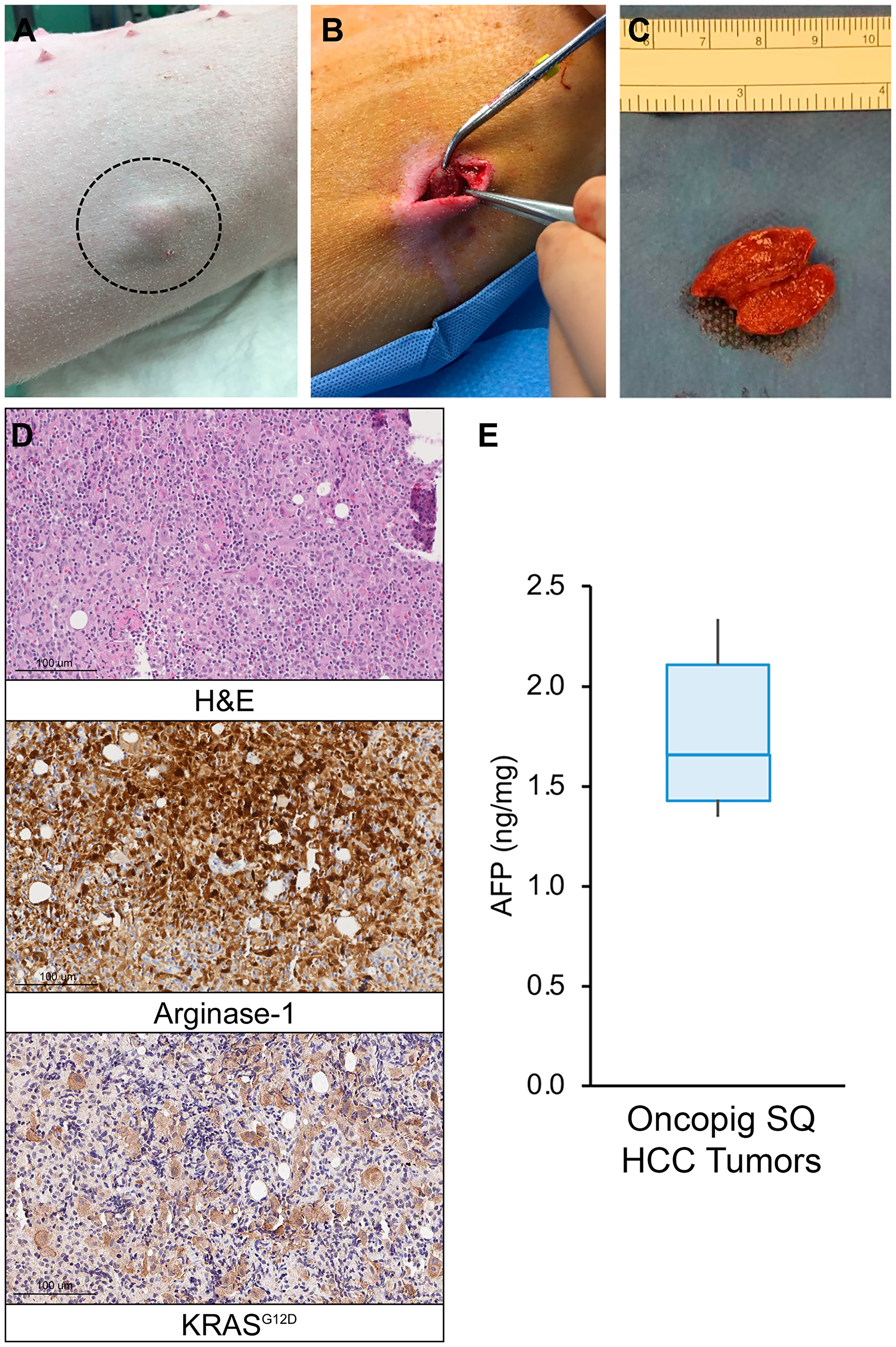 Oncopig SQ HCC autograft formation