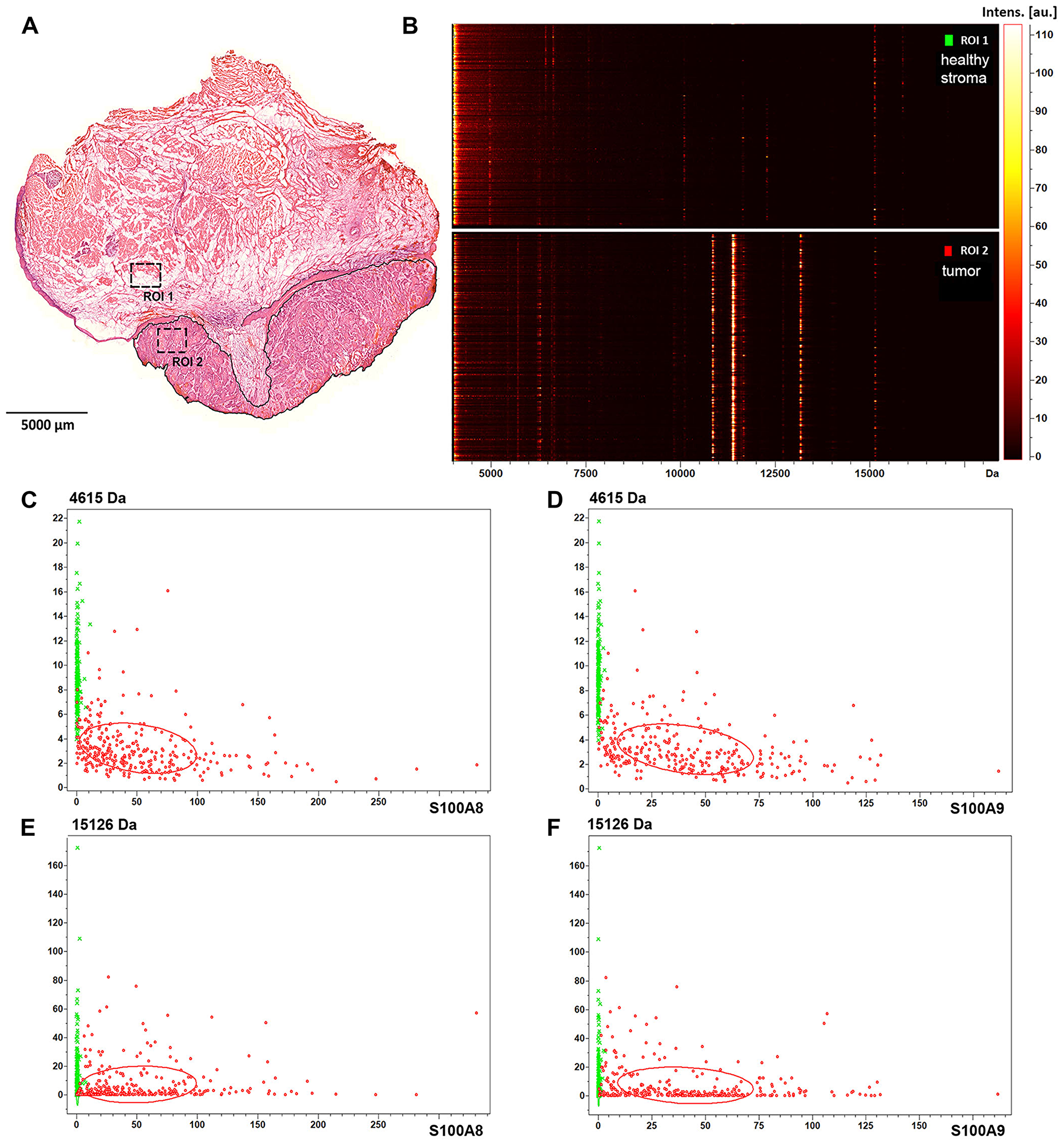Protein expression and spatial distribution analysis of biopsy size regions of the tissue sample