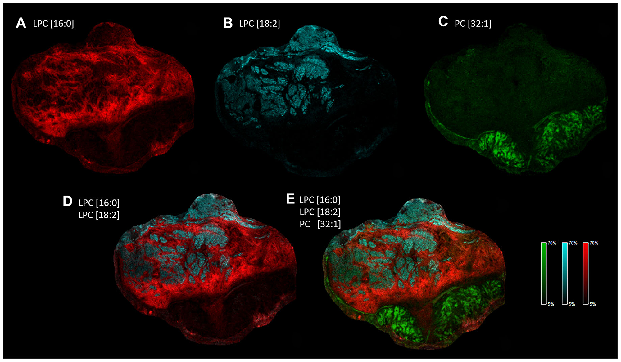 Heterogeneous distribution of specific LPC and PC species in the tissue sample
