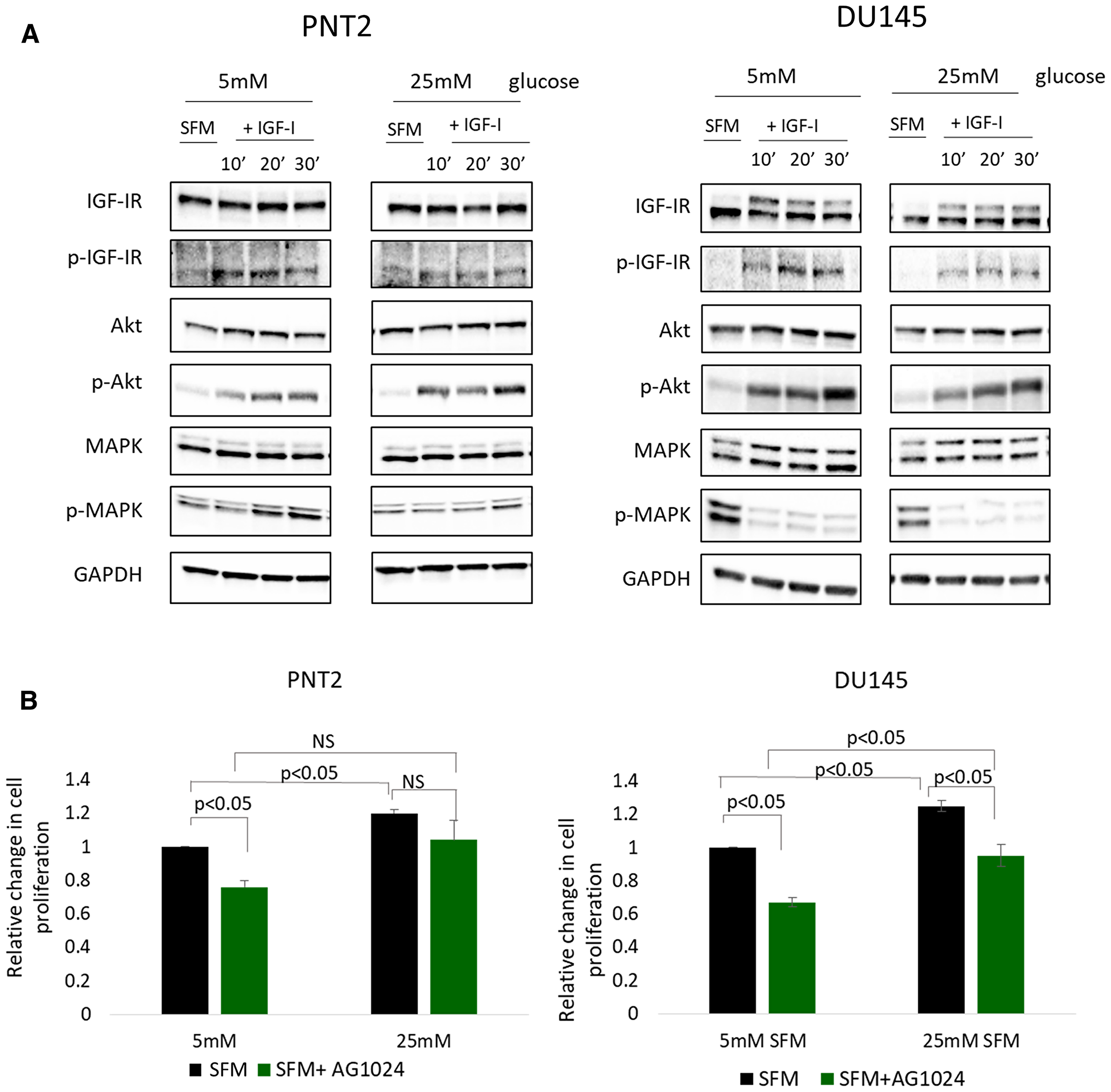 High glucose-induced EMT in prostate cells is independent of IGFI-R