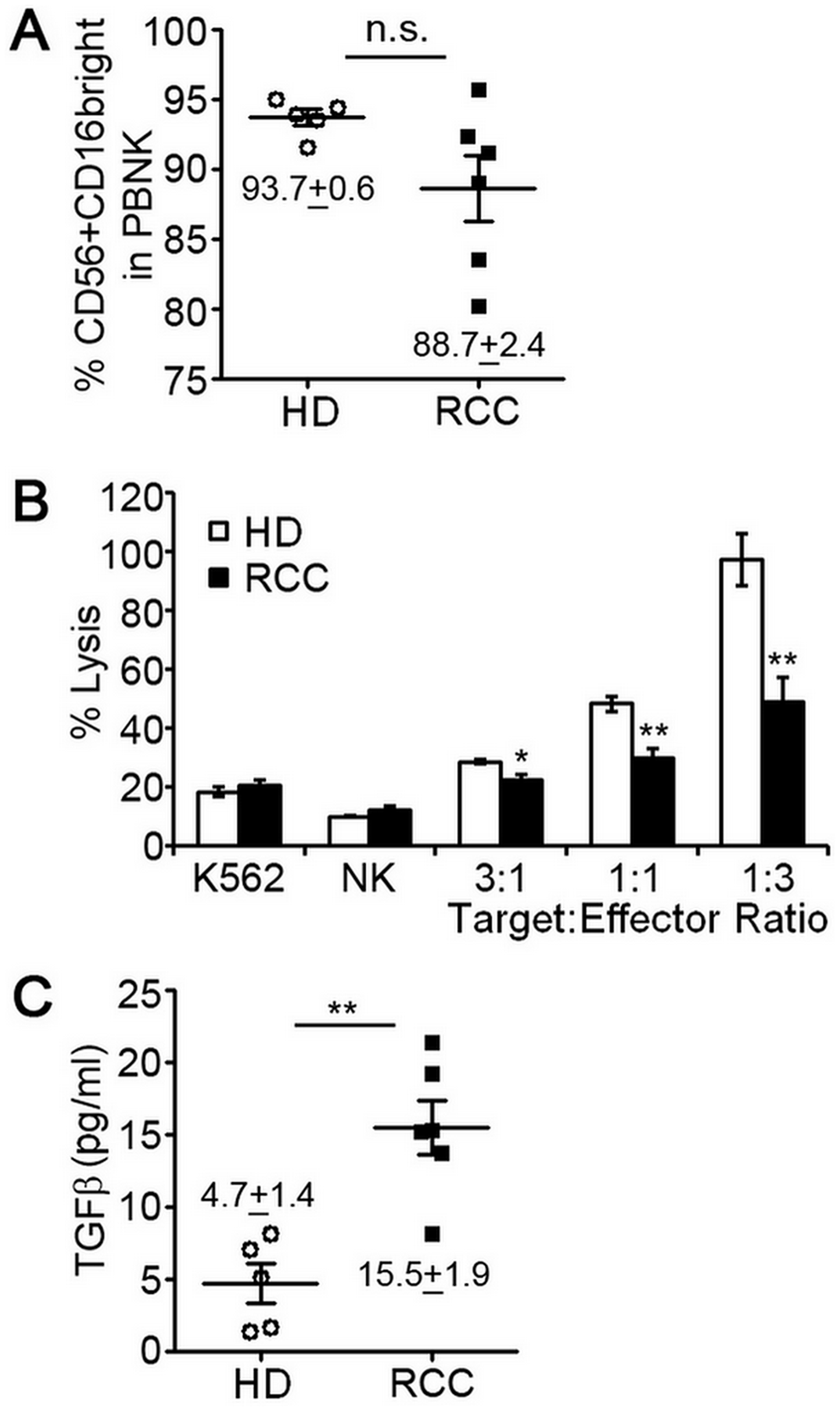 Peripheral blood NK cells of RCC patients have decreased cytotoxic function