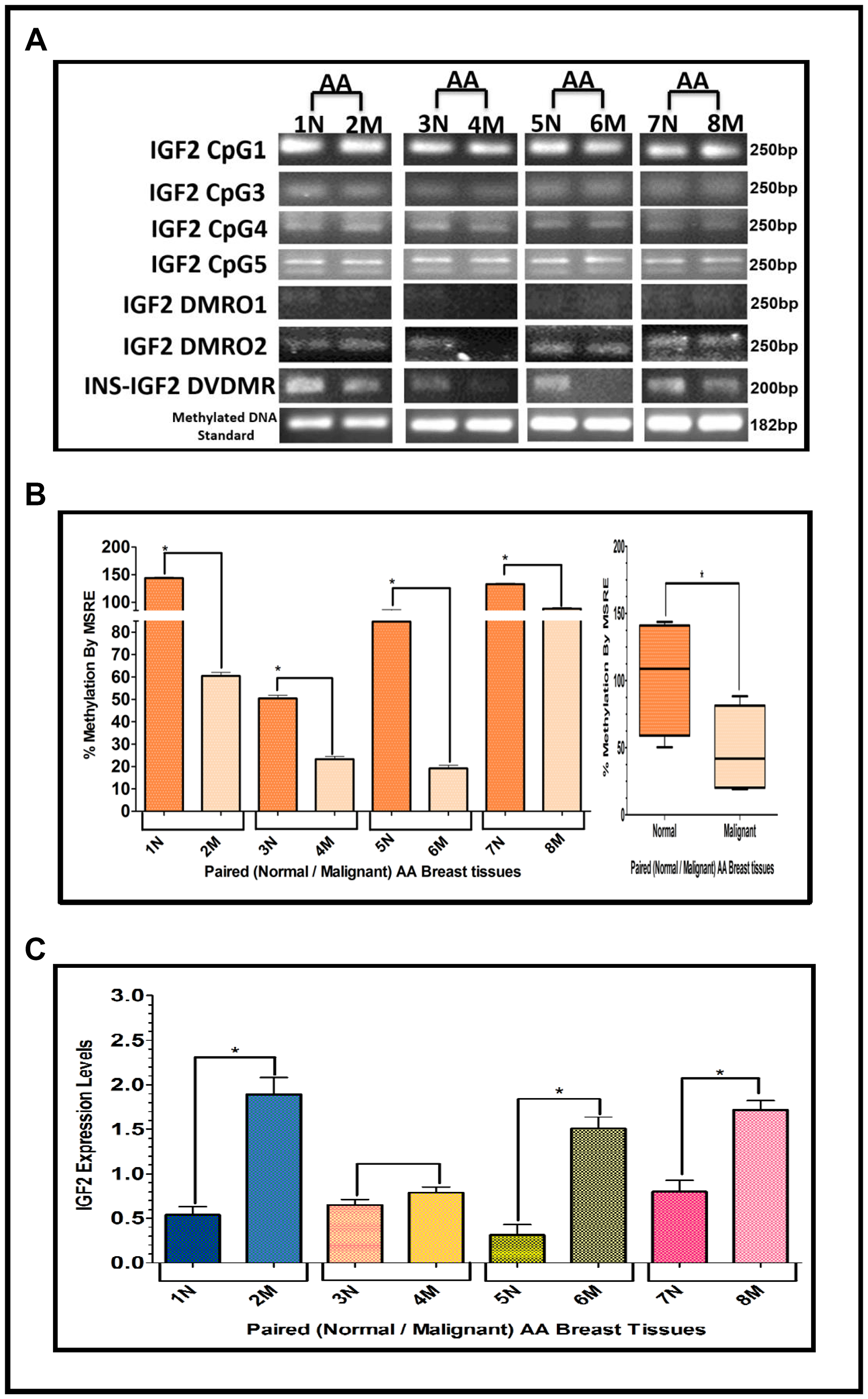 (A–C) EtBr Agarose gel of IGF2 CpG islands and DMRO’s and Bar graphs of % methylation and IGF2 protein levels in paired normal/malignant breast tissues from AA women. (A) shows one of two ethidium bromide stained agarose gels of Bisulphite g-DNA fragments produced by conventional PCR amplification of the CpG and DMRO regions of the IGF2 gene in paired breast tissues of AA women. (B) Shows a comparative bar graph of the methylation of the INS-IGF2 DVDMR in paired tissues from AA women. Average % MSRE Methylation shown by Box and Whisker Plots. (C) Bar graph shows the IGF2 levels from paired breast tissues from AA women assessed by Reverse Phase Protein Array (RPPA) assay. The details of the paired breast tissue samples shown in Table 2. *symbol denotes paired samples (Normal/Malignant) from same patient.