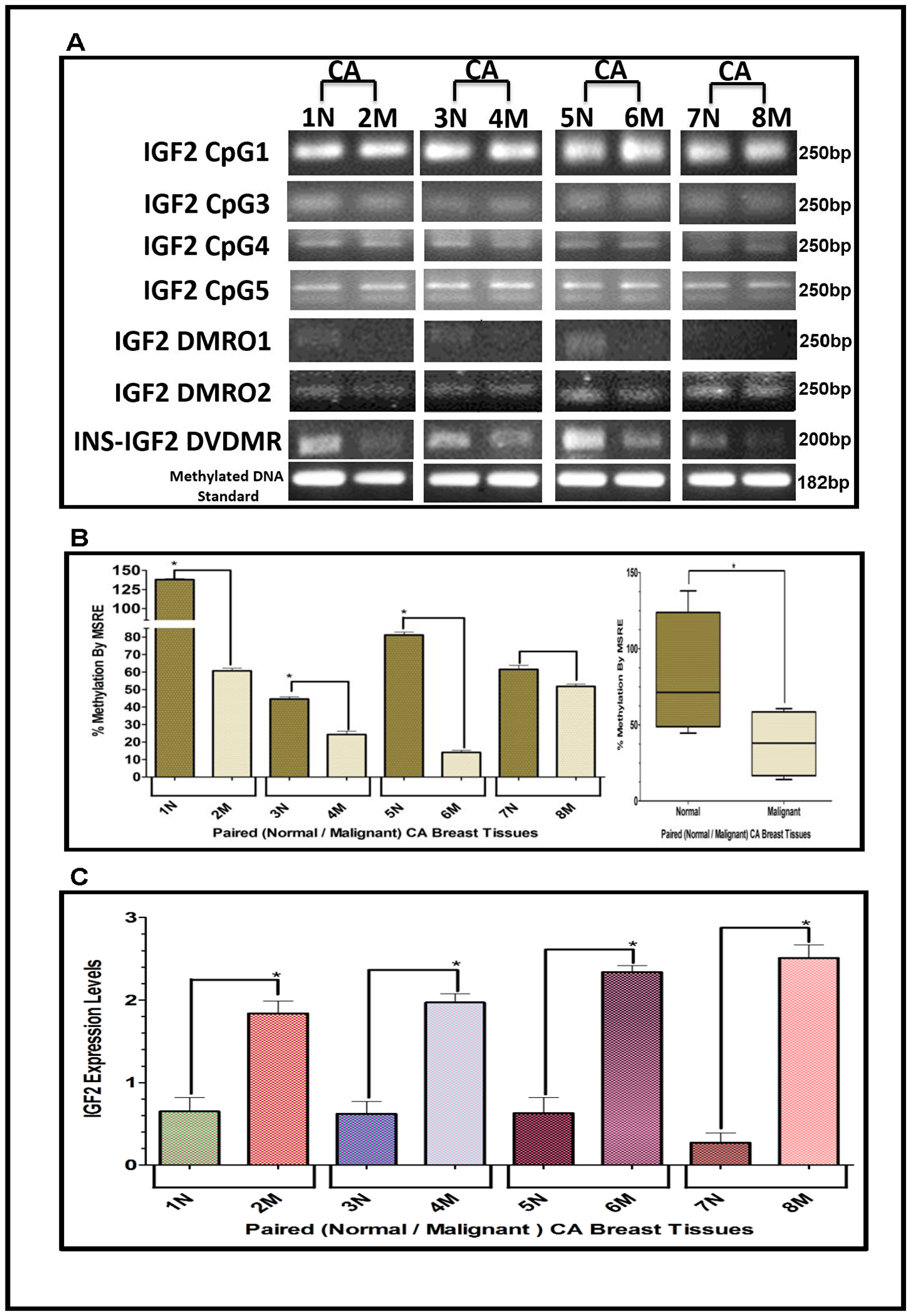(A–C) EtBr Agarose gel of IGF2 CpG islands and DMRO’s and Bar graphs of % methylation and IGF2 protein levels in paired normal/malignant breast tissues from CA women. (A) shows one of two ethidium bromide stained agarose gels of bisulphite g-DNA fragments produced by conventional PCR amplification of the CpG and DMRO regions of the IGF2 gene in paired breast cancer tissues from Caucasian American (CA) women. (B) shows a comparative bar graph of the methylation of the INS-IGF2 DVDMR in paired tissues from CA women. Average % MSRE Methylation shown by Box and Whisker Plots. (C) shows a bar graph of the IGF2 levels in the paired breast tissues from CA women assessed by the RPPA assay. The Breast Cancer tissue samples details are shown in Table 2. *symbol denotes paired samples (Normal/Malignant) from same patient.