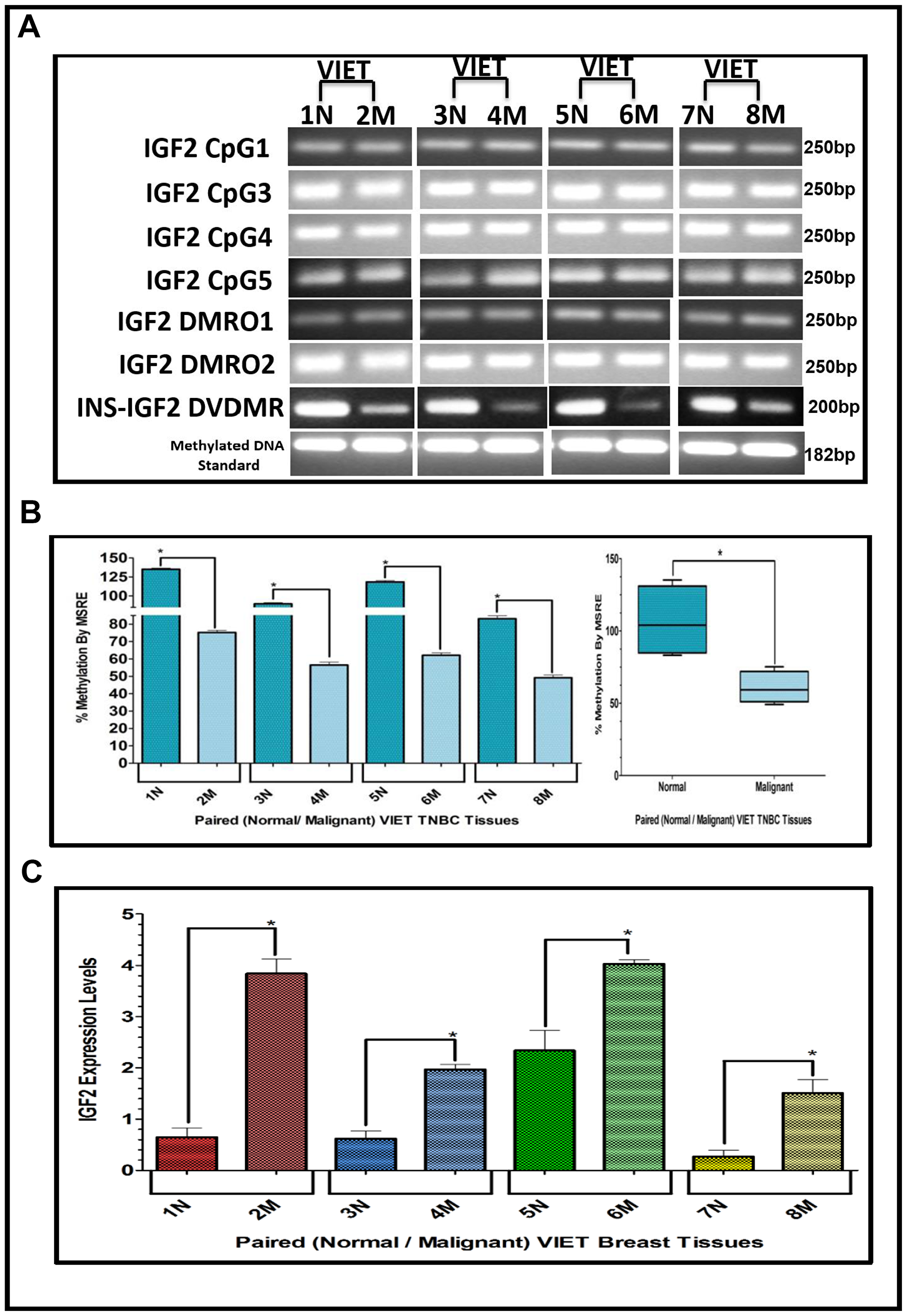 (A–C) EtBr Agarose gel of IGF2 CpG islands and DMRO’s and Bar graphs of % methylation and IGF2 protein levels in paired normal/malignant breast tissues from VIET women. (A) shows an ethidium bromide stained agarose gel of bisulphite g-DNA fragments produced by PCR amplification of the CpG and DMRO regions of the IGF2 gene in paired breast cancer tissues from Vietnamese women (VIET); (B) Shows a comparative bar graph of the methylation of the INS-IGF2 DVDMR in paired tissues VIET by Methyl Sensitive Restriction Enzyme (MSRE) qPCR; Average % MSRE Methylation shown by Box and Whisker Plots. (C) Bar graph of the IGF2 levels in paired breast tissues assessed by RPPA assay. The TNBC tissue samples details are shown in Table 2. *symbol denotes paired samples (Normal/Malignant) from same patient.