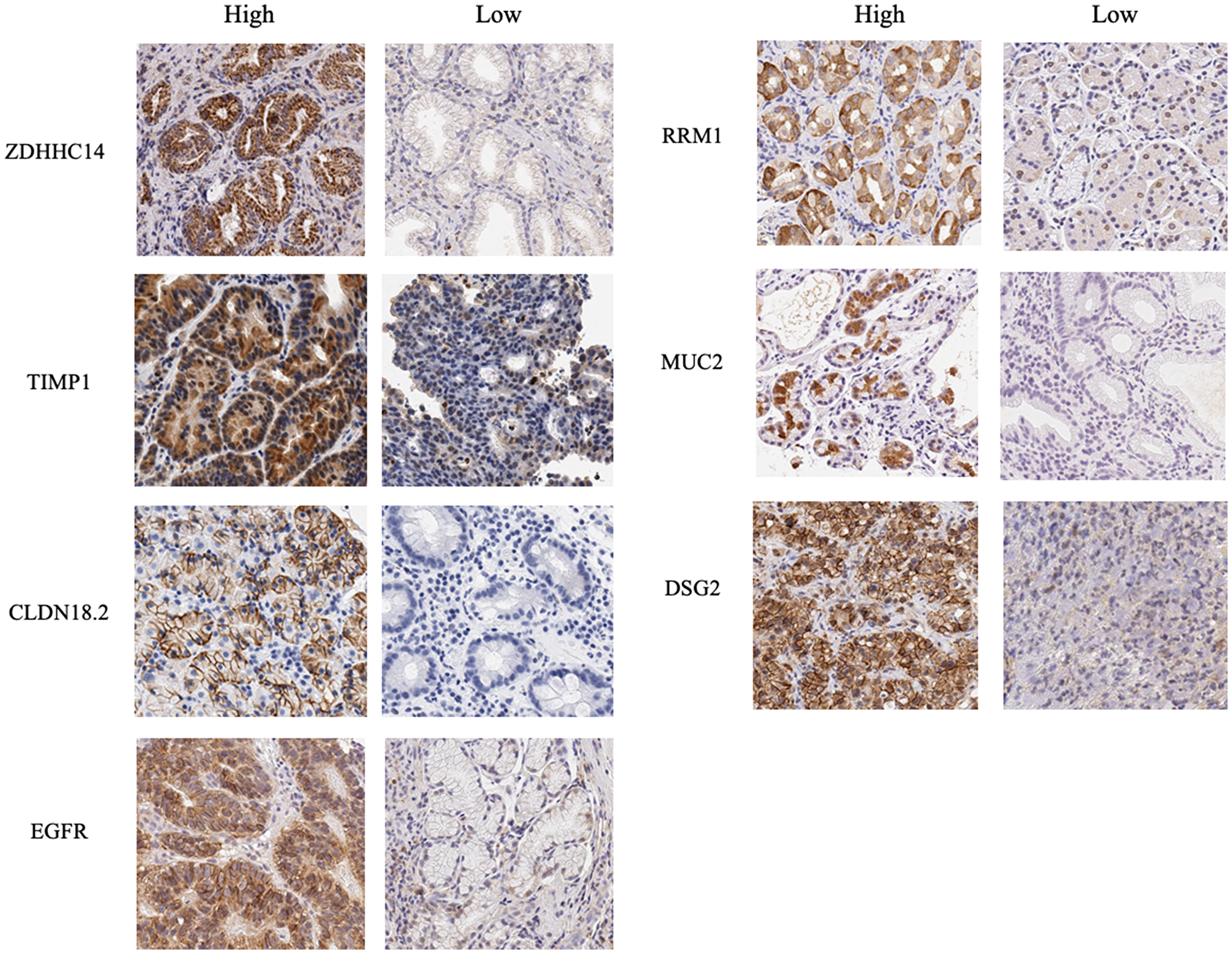 Immunohistochemical images for proteins encoded by seven biomarker candidate genes