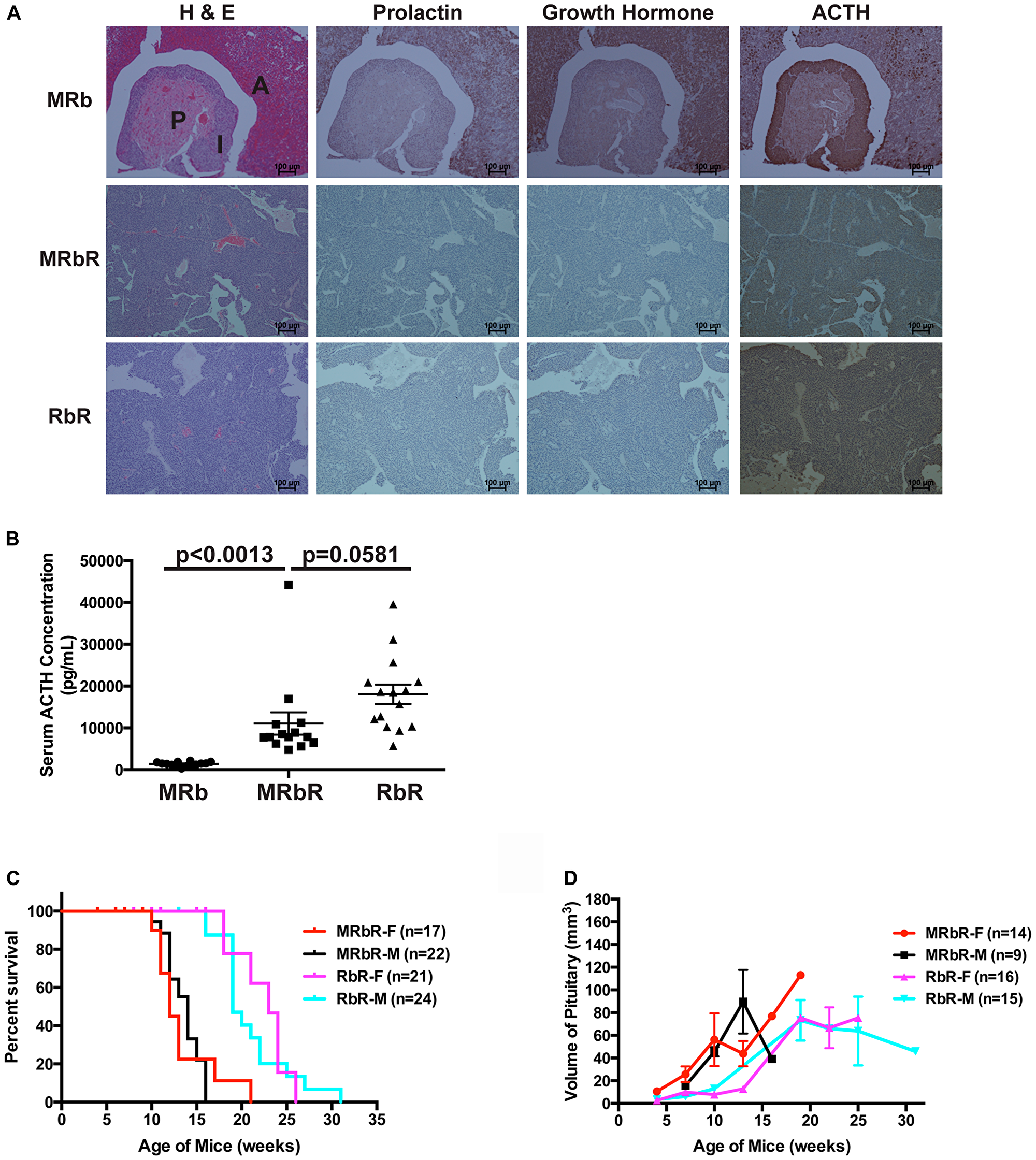 MRbR mice developed ACTH-secreting PitNETs