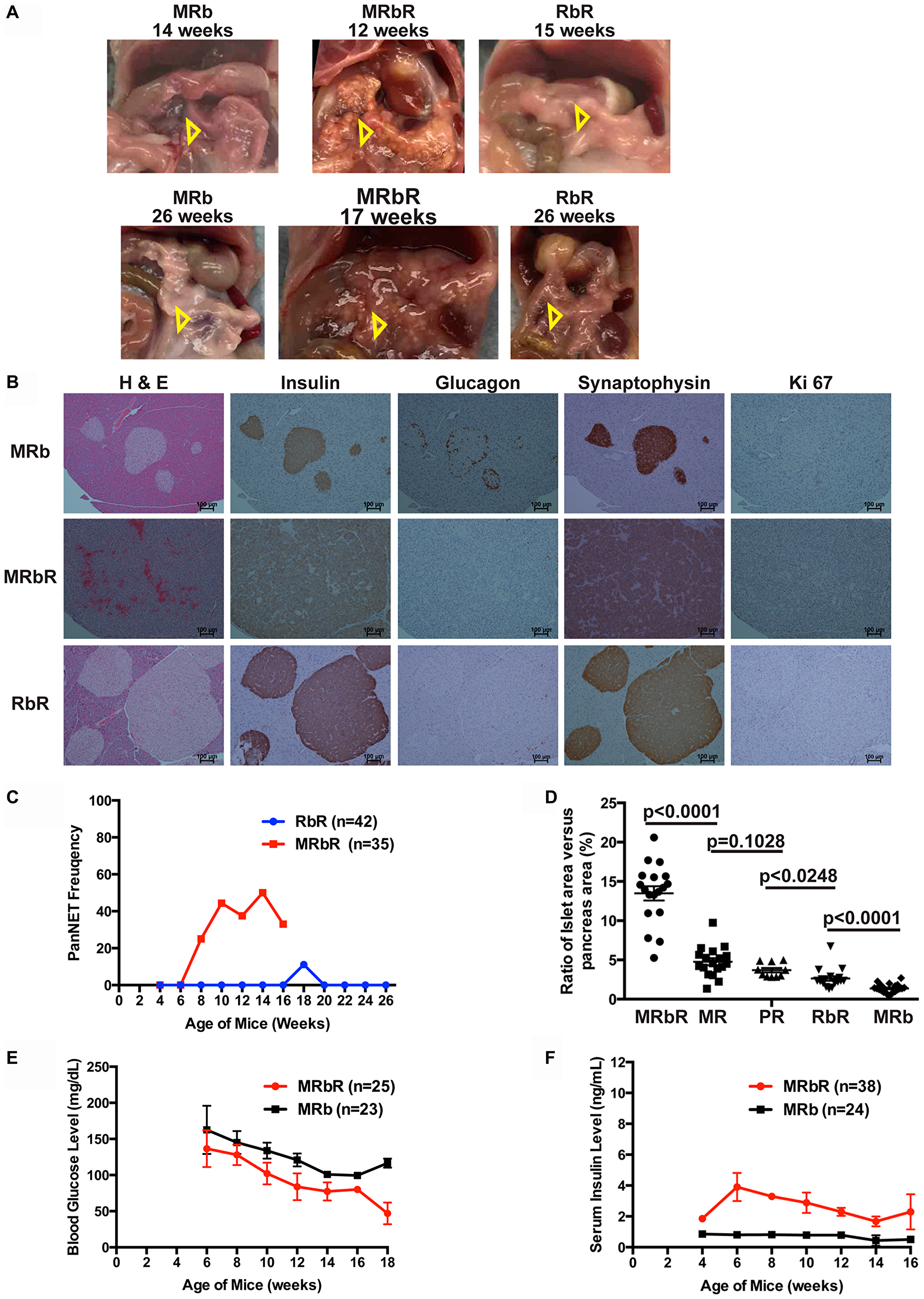 Concomitant loss of Men1 and Rb1 accelerated PanNET development in MRbR mice