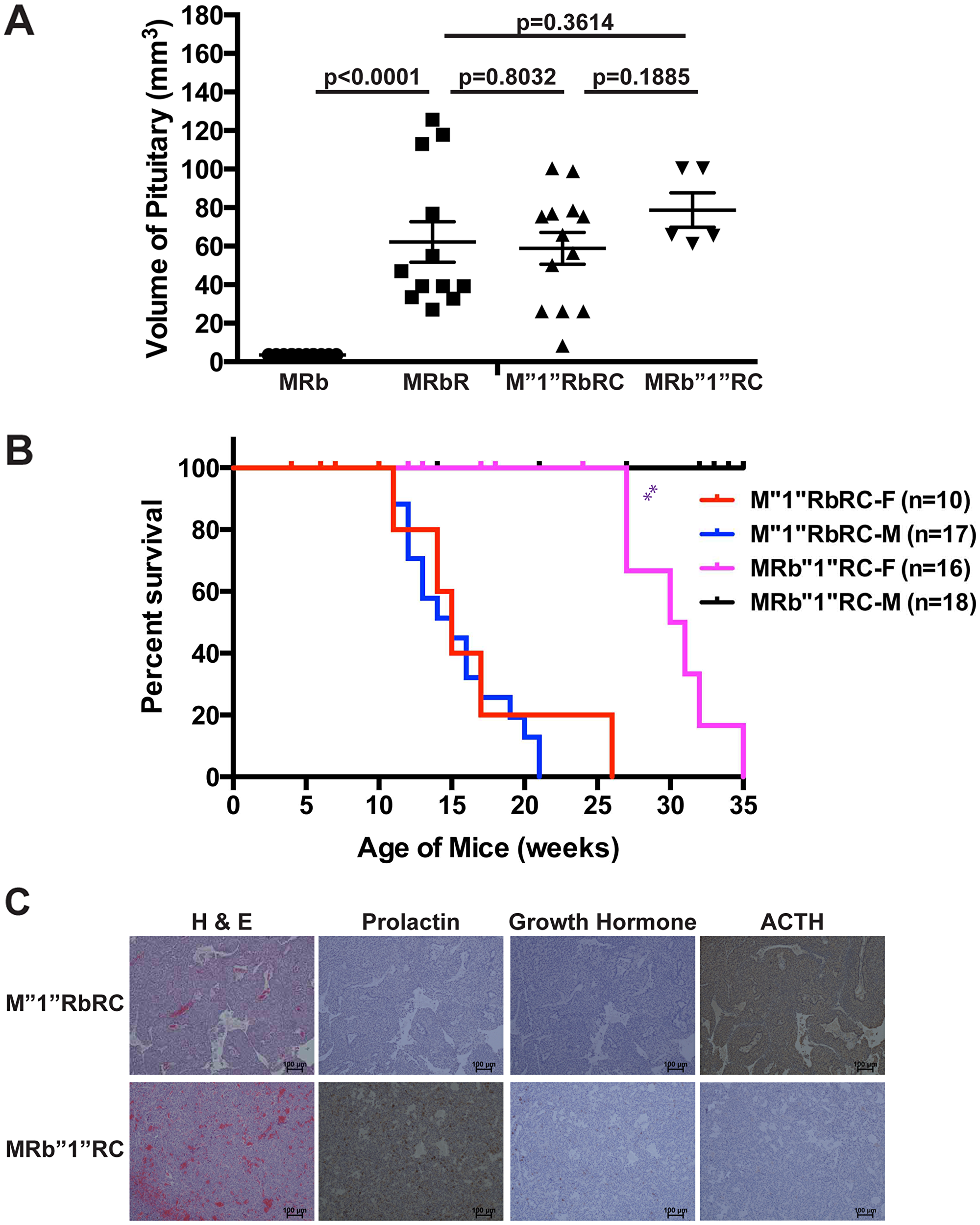 TSG Rb1 plays a more significant role in suppressing PitNETs compared to Men1