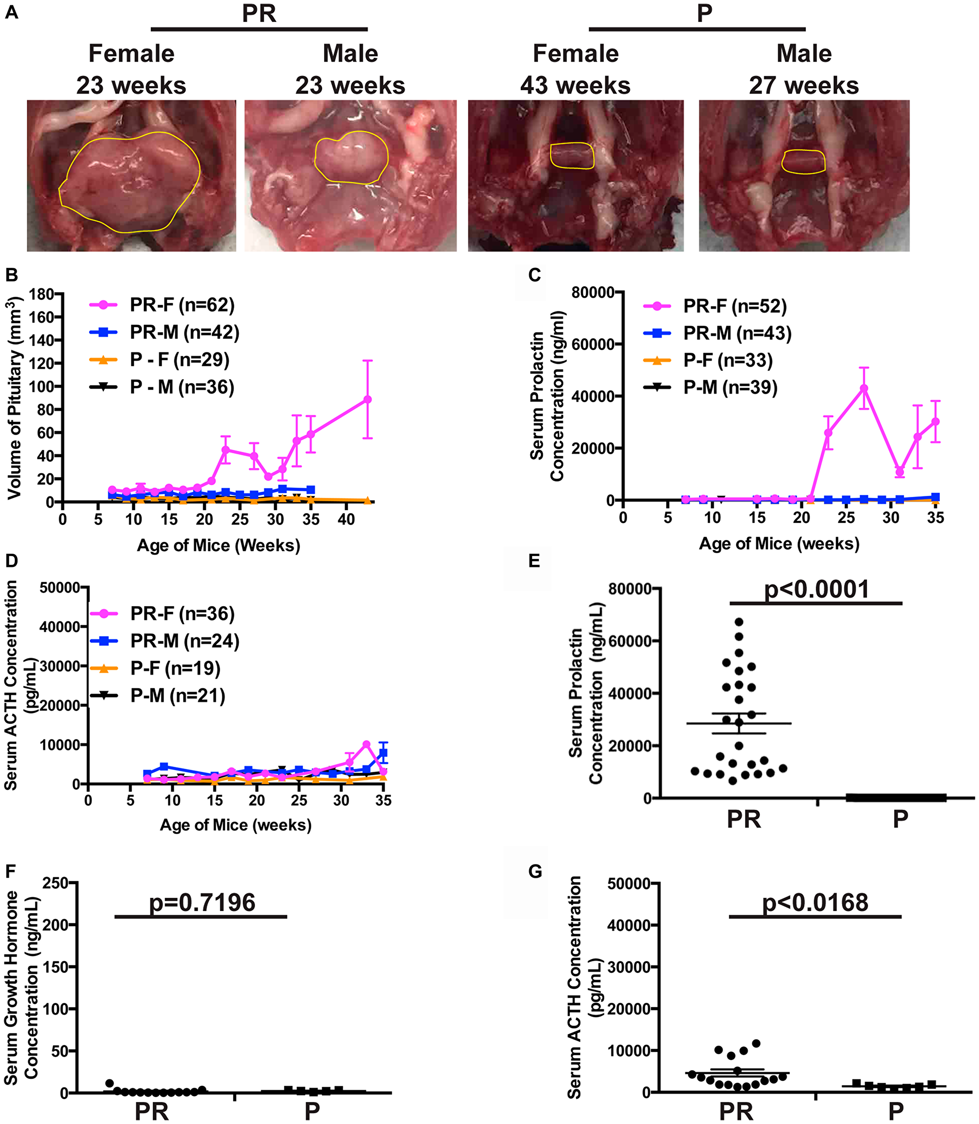 Deletion of TSG Pten alone led to PitNETs