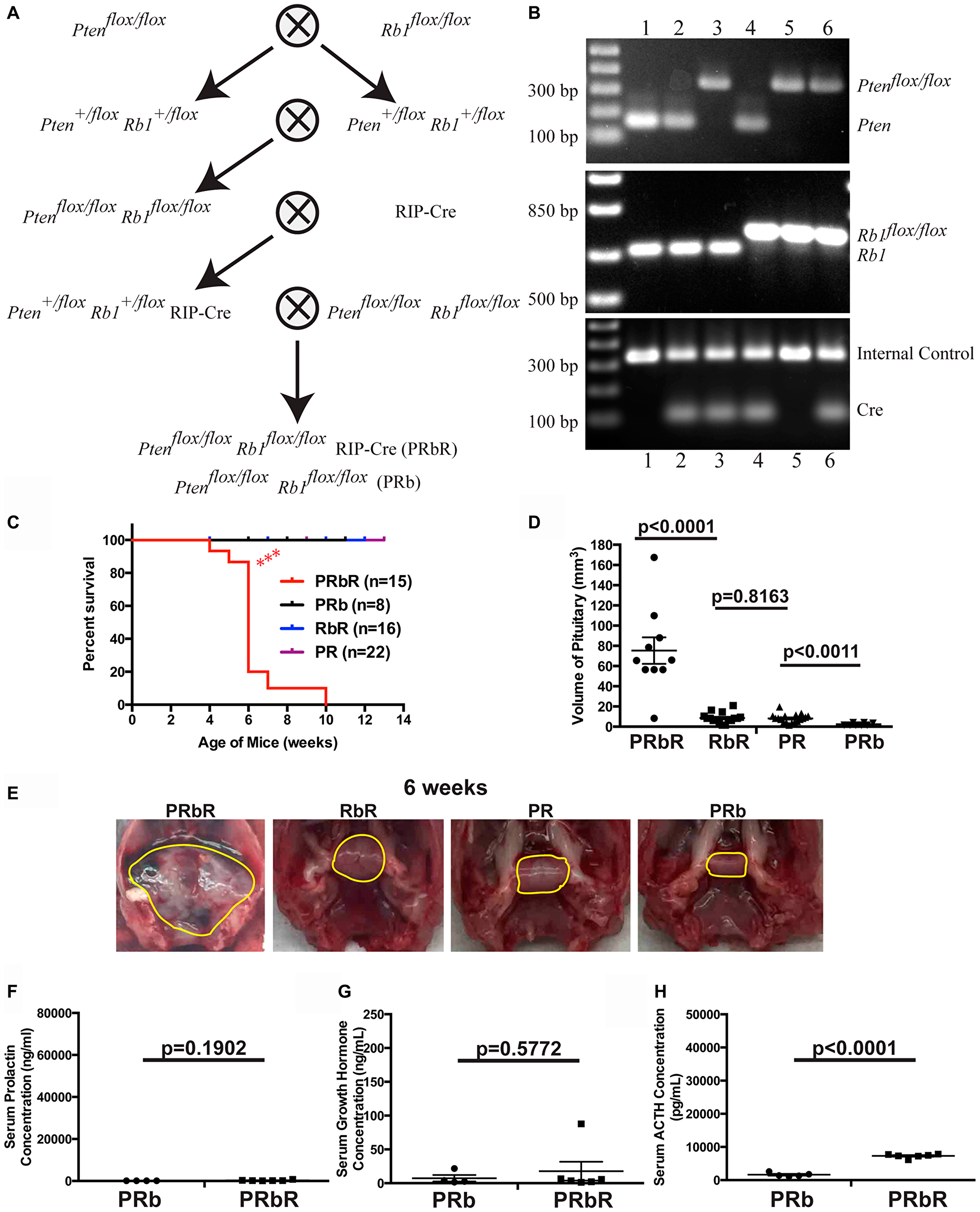 Pten and Rb1 function cooperatively to suppress PitNETs
