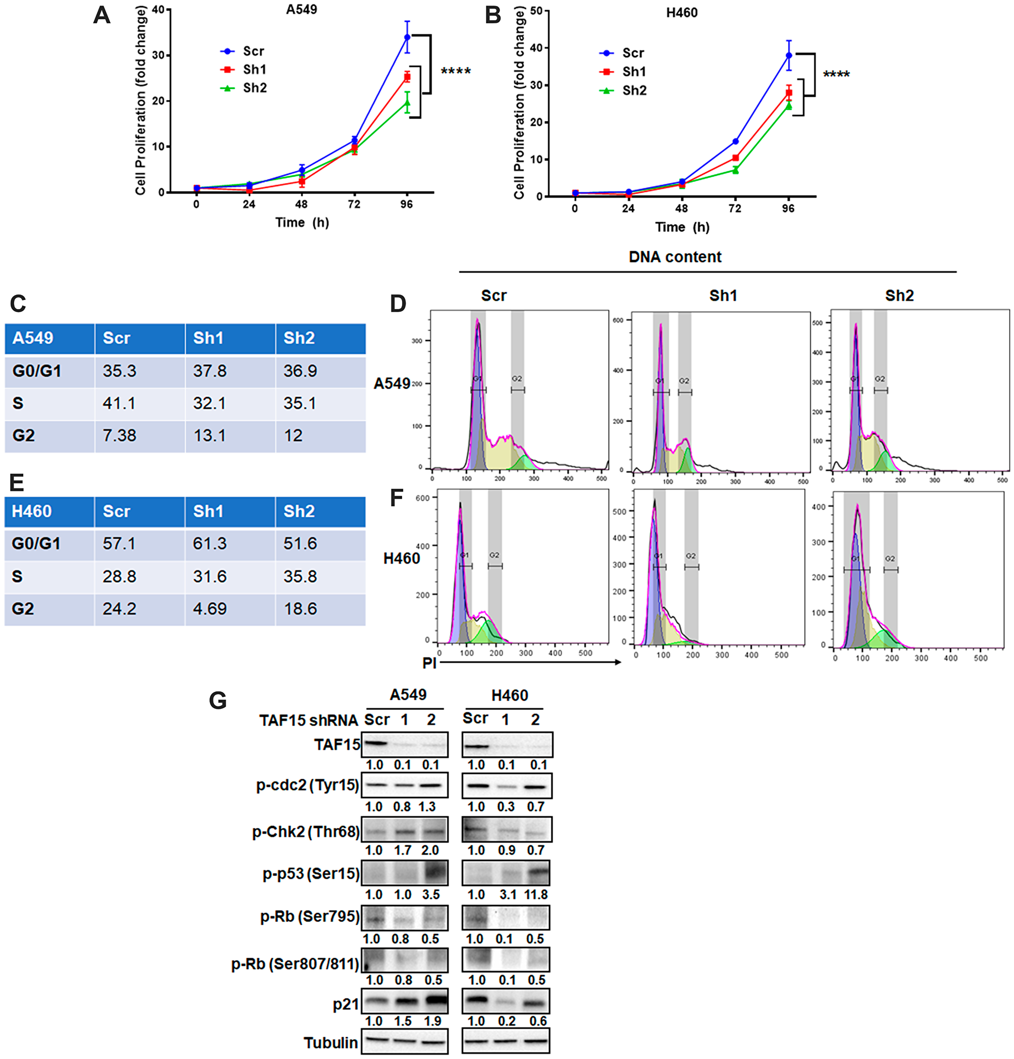 TAF15 silencing inhibits NSCLC proliferation by arresting the cell cycle