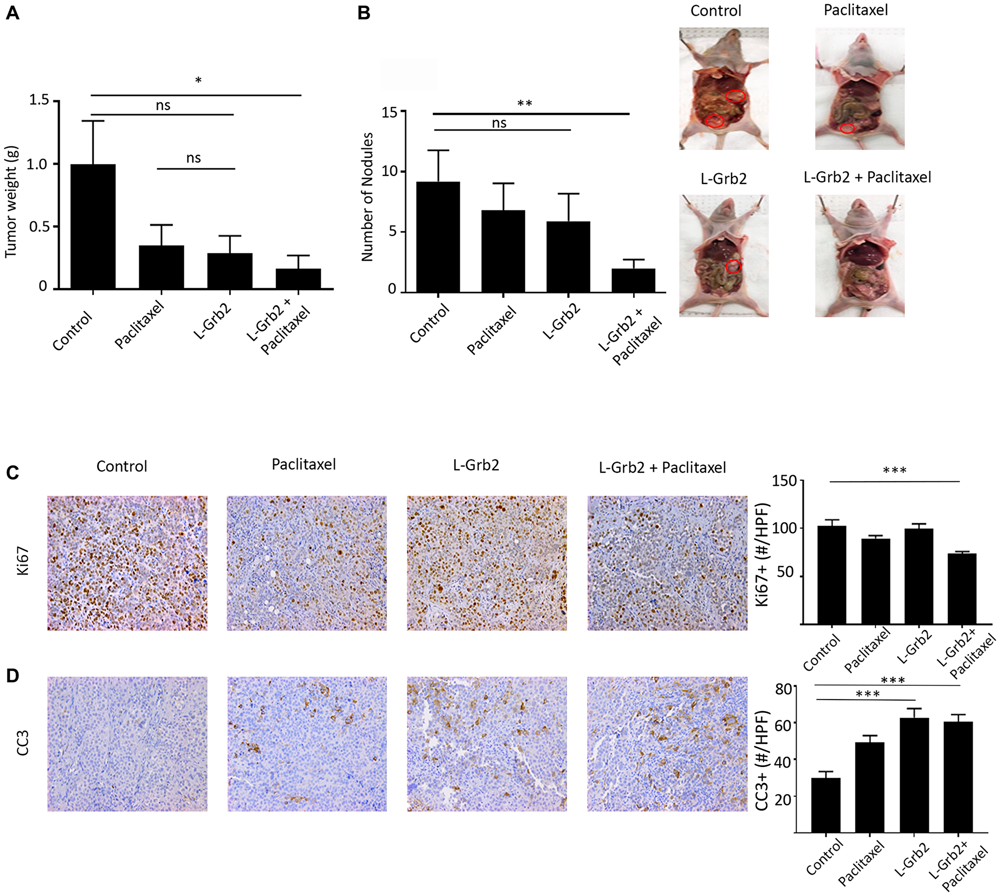 Effects of treatment with L-Grb2 on ovarian tumor growth