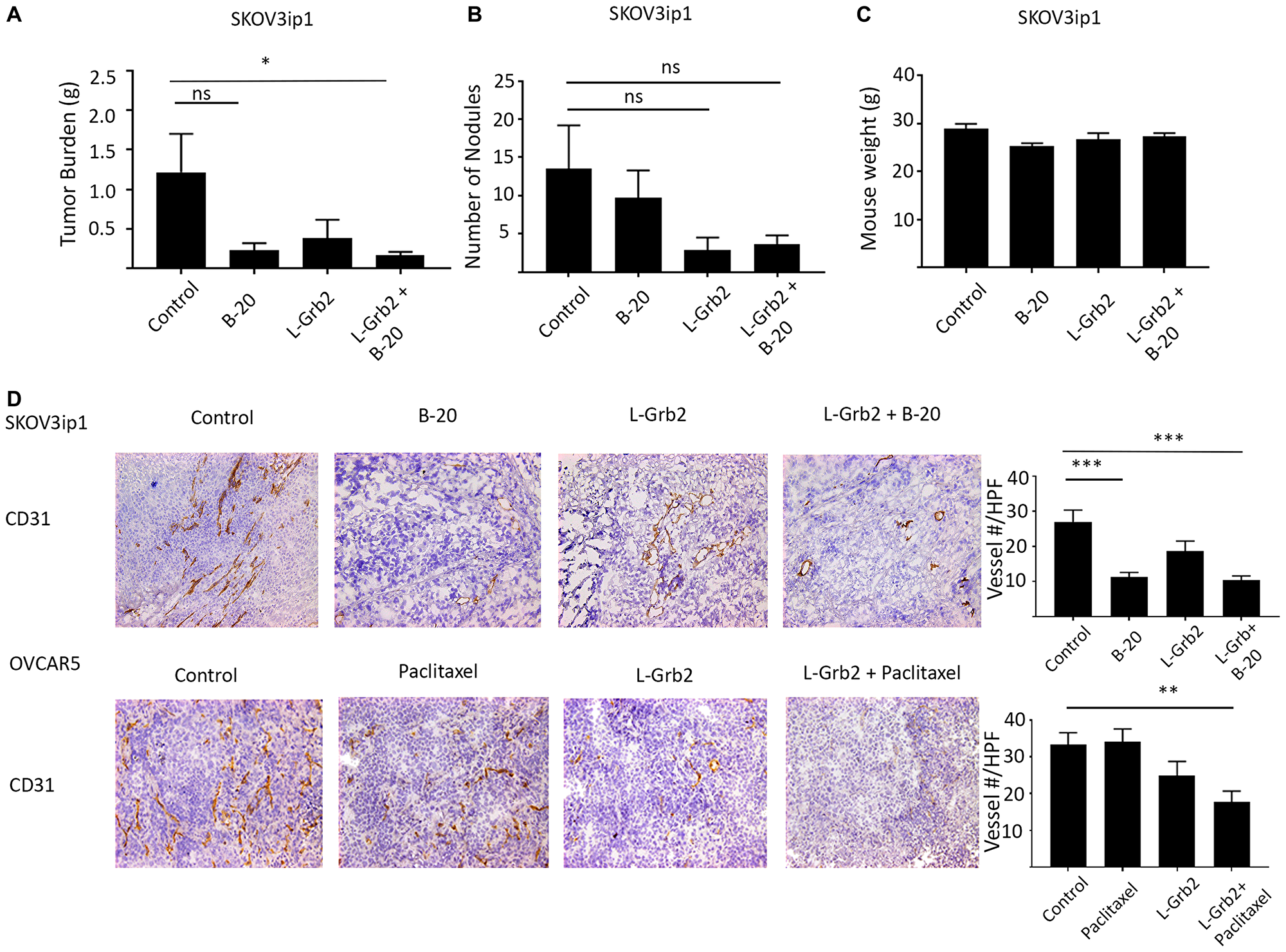 In vivo effects of treatment with L-Grb2 in combination with anti-angiogenic therapy in an ovarian tumor model