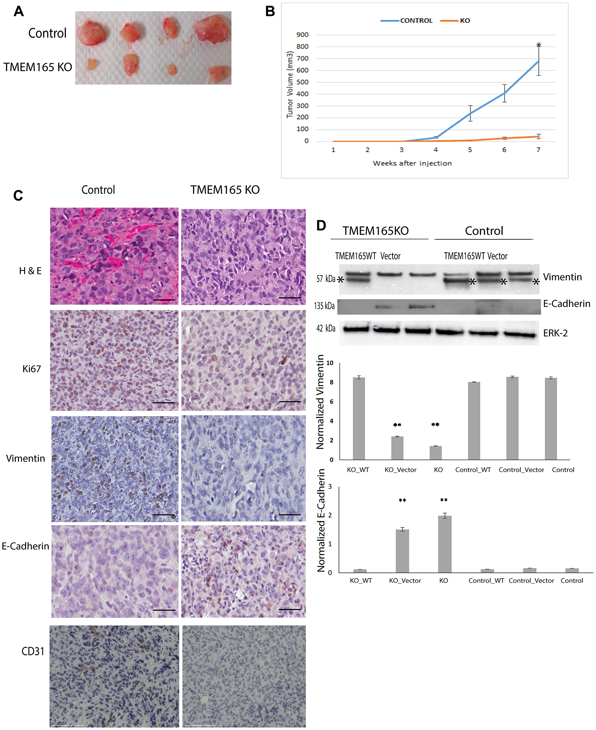 TMEM165 knockout inhibits breast cancer growth in a xenograft model