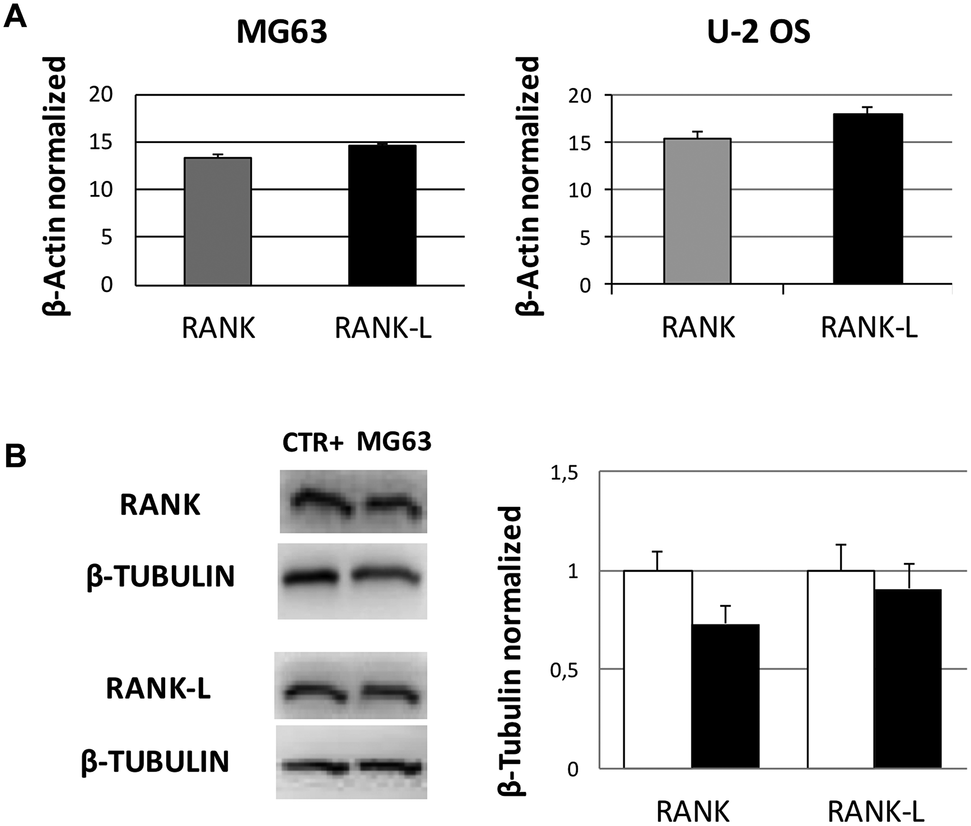 RANK and RANK-L mRNA and protein expression levels in OS cell lines