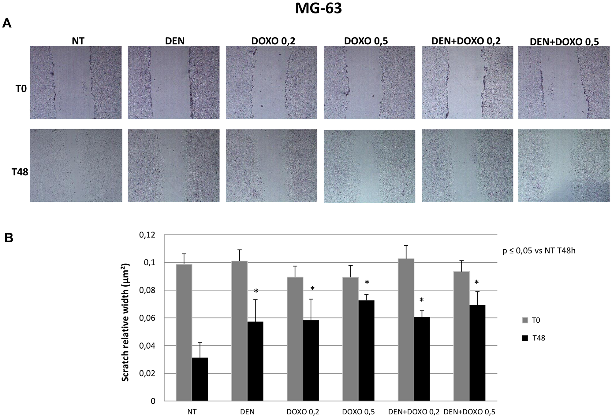 Invasive capacity evaluation in MG63 cells after treatment with Den and Doxo (Scratch Assay)