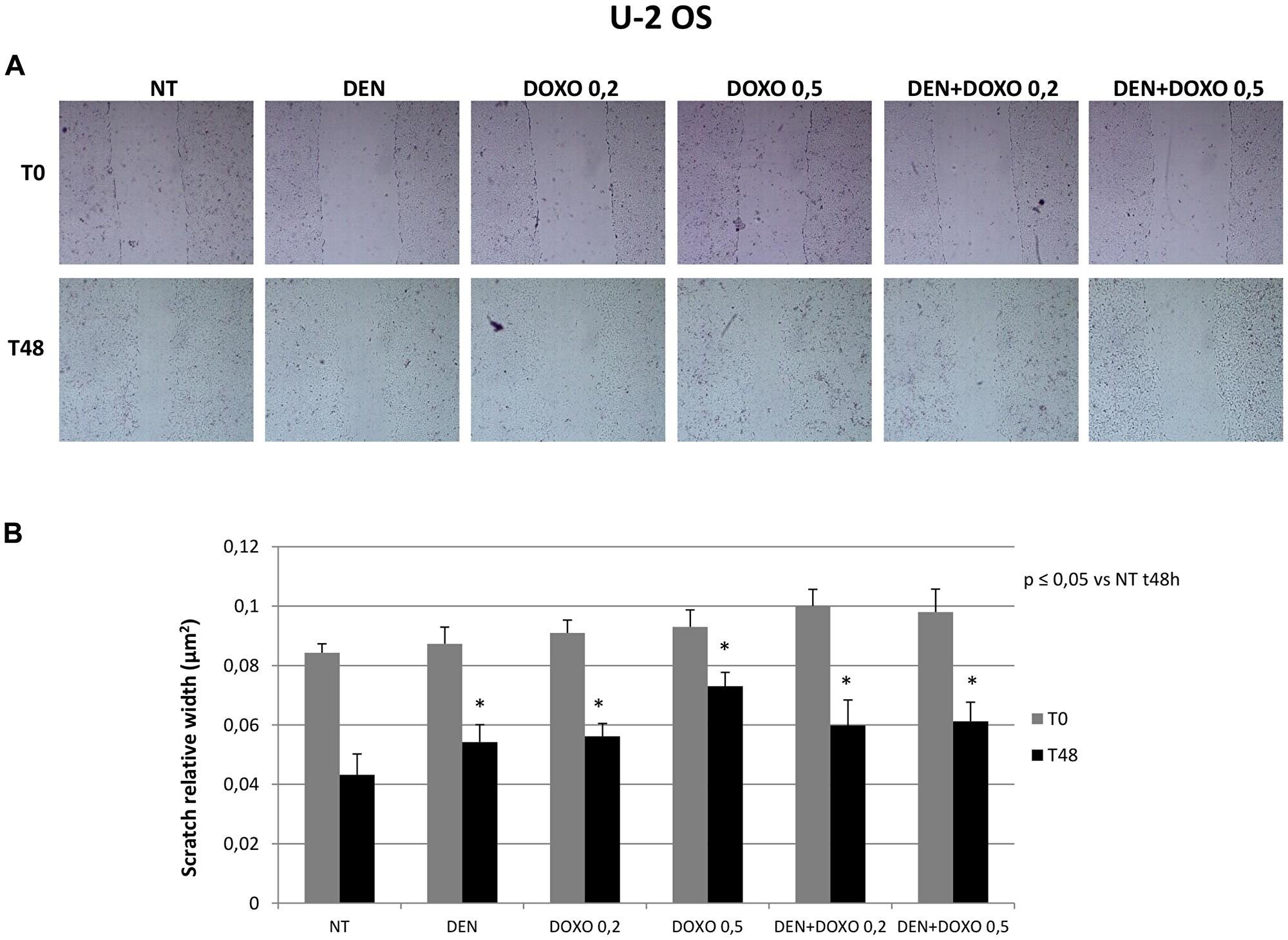 Invasive capacity evaluation in U-2 OS cells after treatment with Den and Doxo (scratch assay)