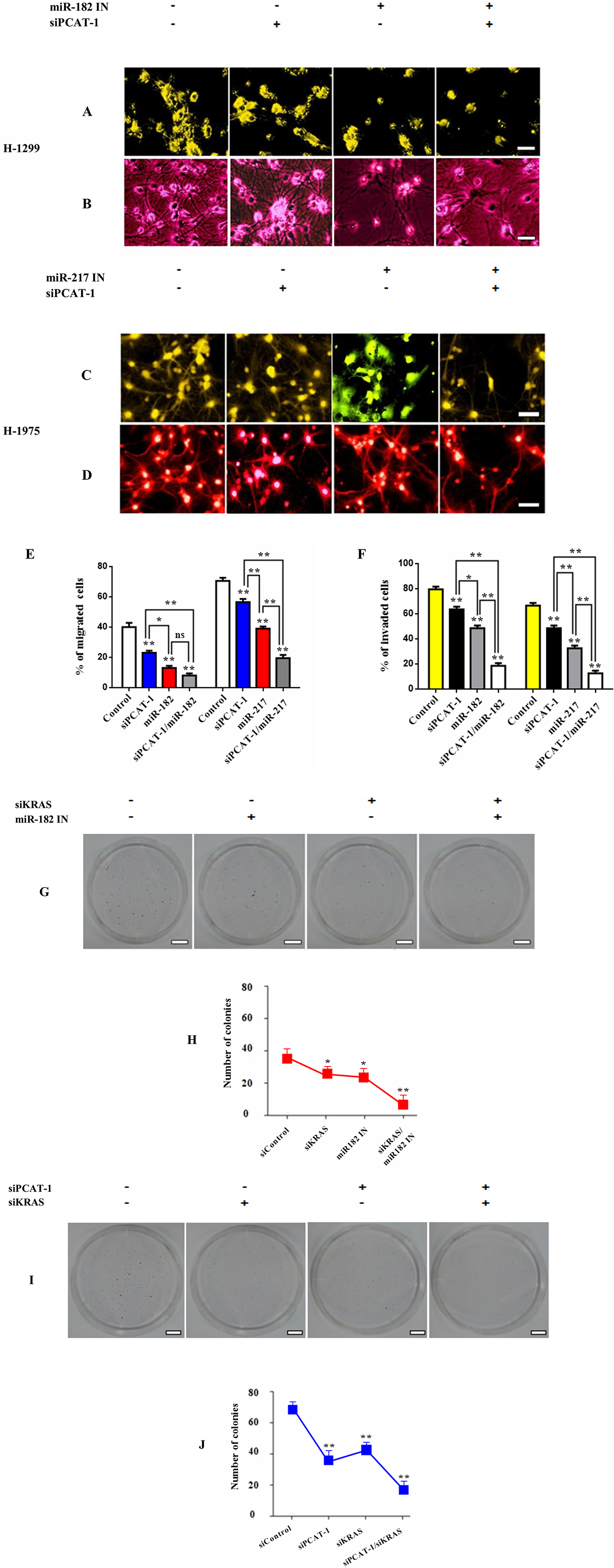 PCAT-1 regulates expression of immunosuppressive miR182/miR-217 signaling axis