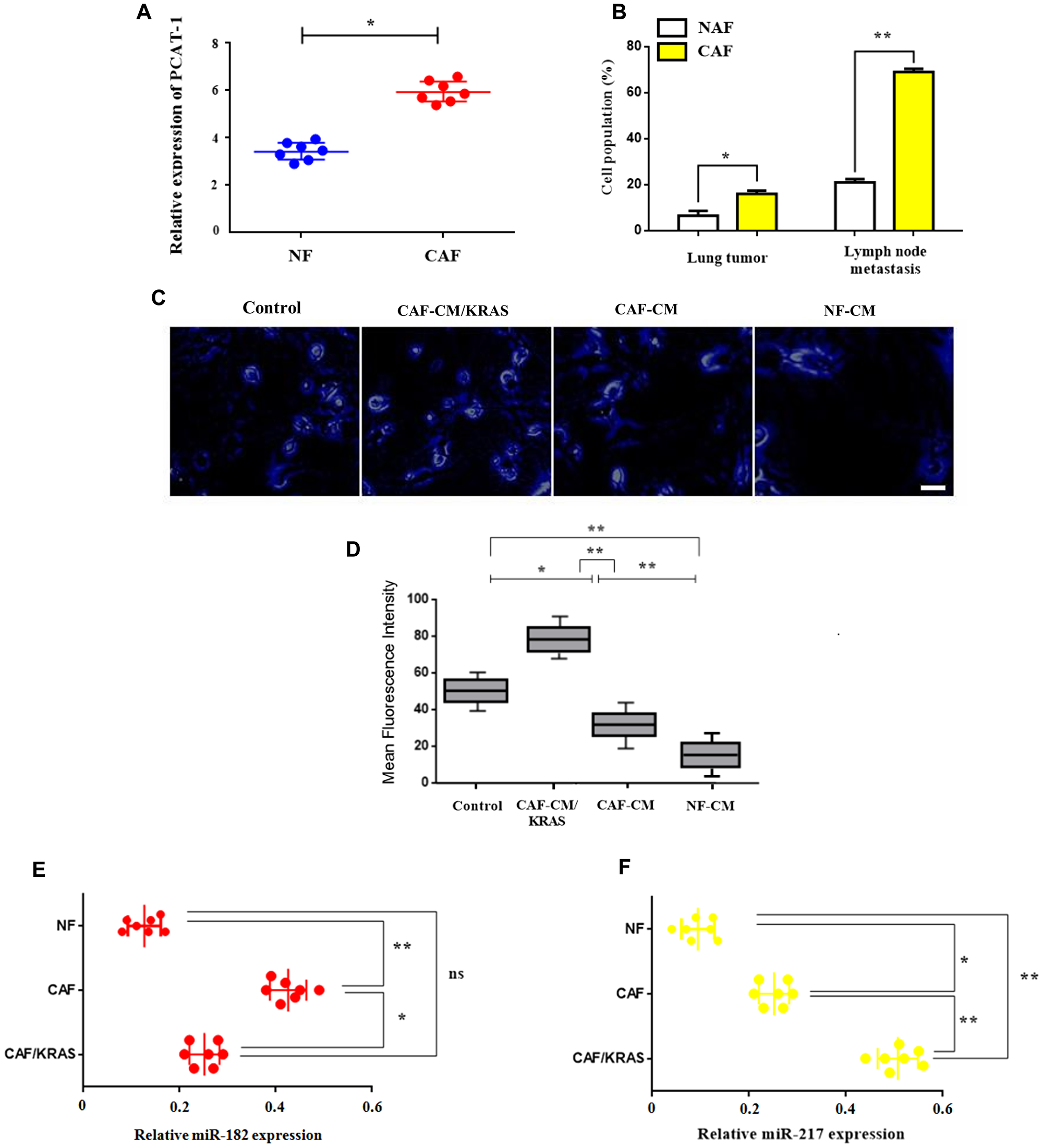 Enhanced expression of PCAT-1 triggers CAF infiltration via miR182/miR217 amplification