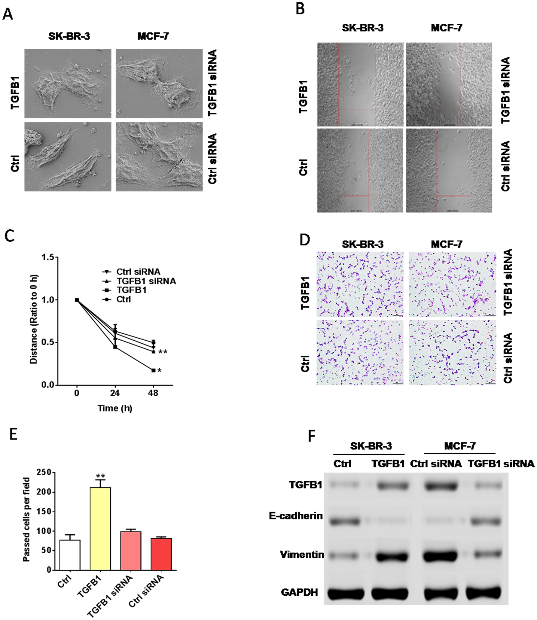 TGF-β1 promoted EMT in breast cancer
