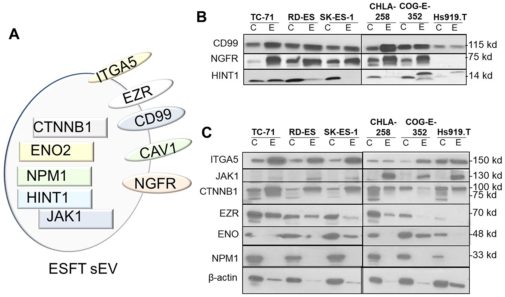 Identification of potential sEV-associated ESFT biomarkers