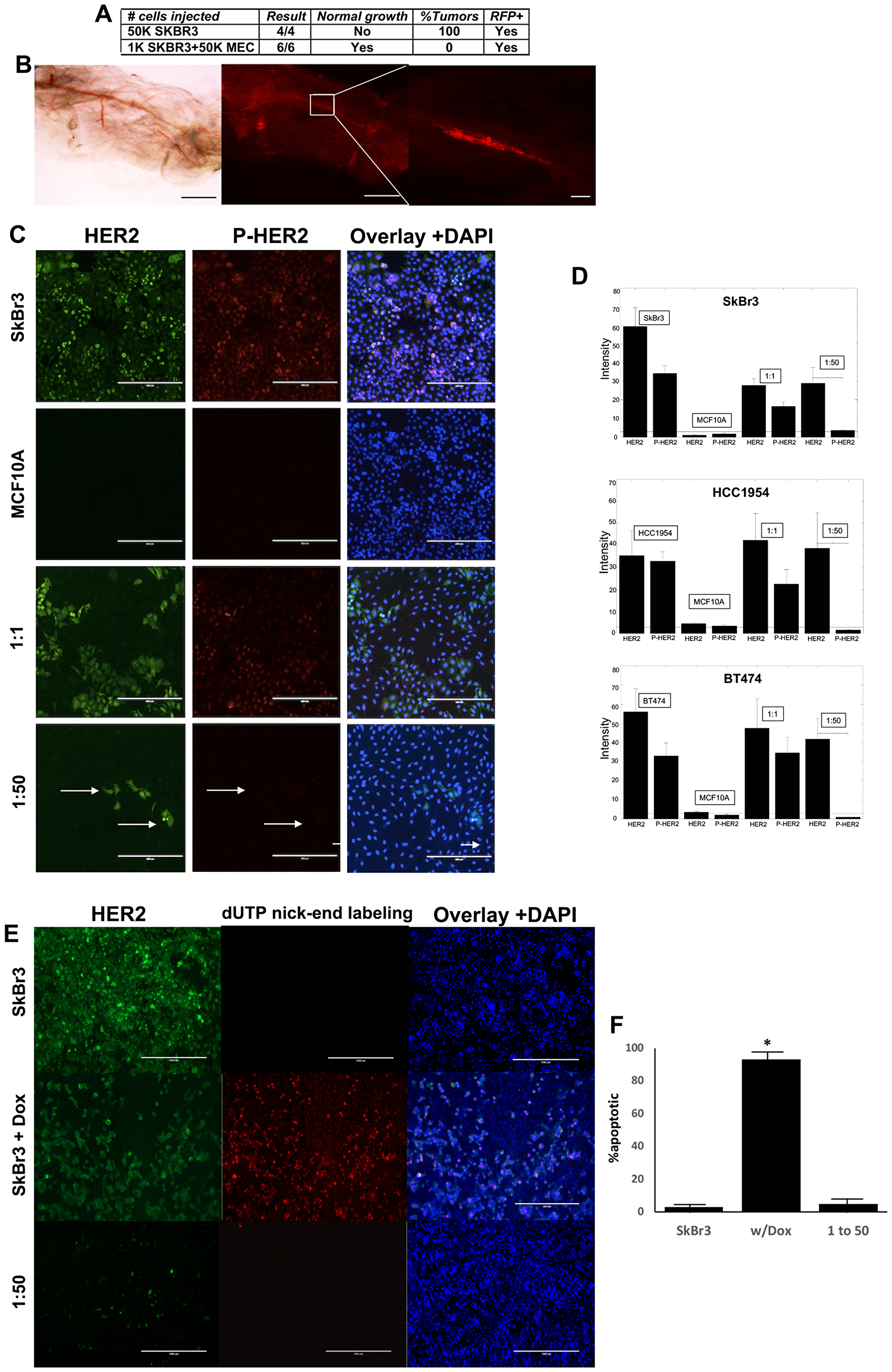 Human HER2+ breast cancer cells are redirected in vivo and in vitro