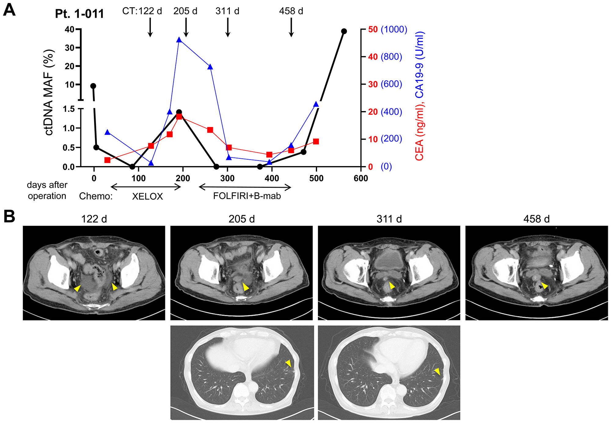 Dynamic change of mutated ctDNA level by chemotherapies