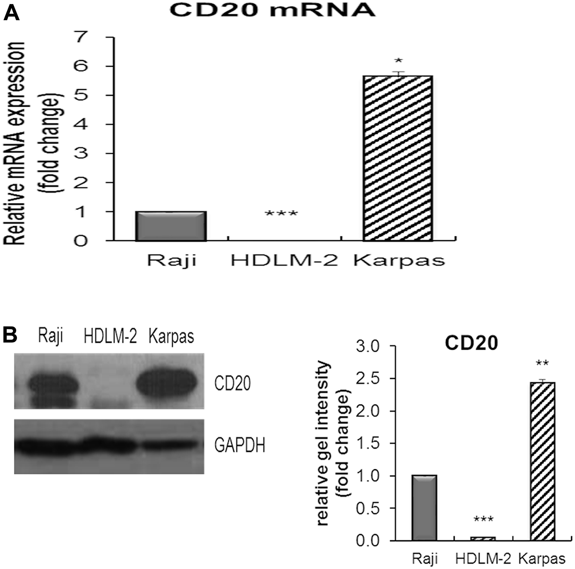 The expression of CD20 mRNA and protein in Karpas-1106 PMBL cells