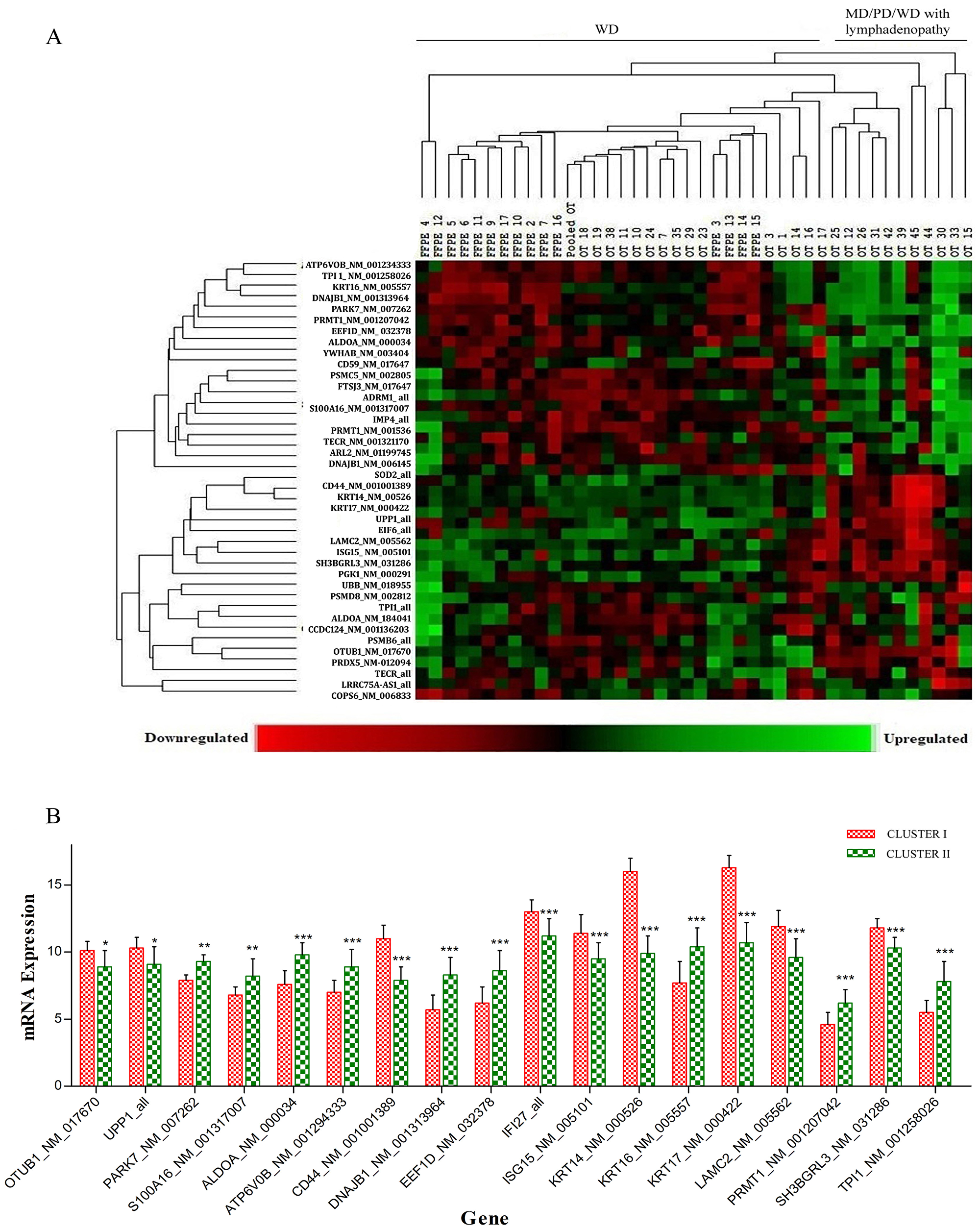 (A) Based on unsupervised clustering significantly differentially regulated transcripts between keratinized WD and keratinized MD/PD/WD with metastatic lymphadenopathy groups. The first cluster including 31 WD and 3 MD tumors with no lymph node involvement. Second cluster included 2 MD and 1 PD with no lymph node involvement including 8 WD tumors with metastatic lymphadenopathy were clustered. (B) of 34 transcripts, 18 transcripts were significantly expressed between the keratinized WD and keratinized MD/PD/WD-metastatic lymphadenopathy groups.