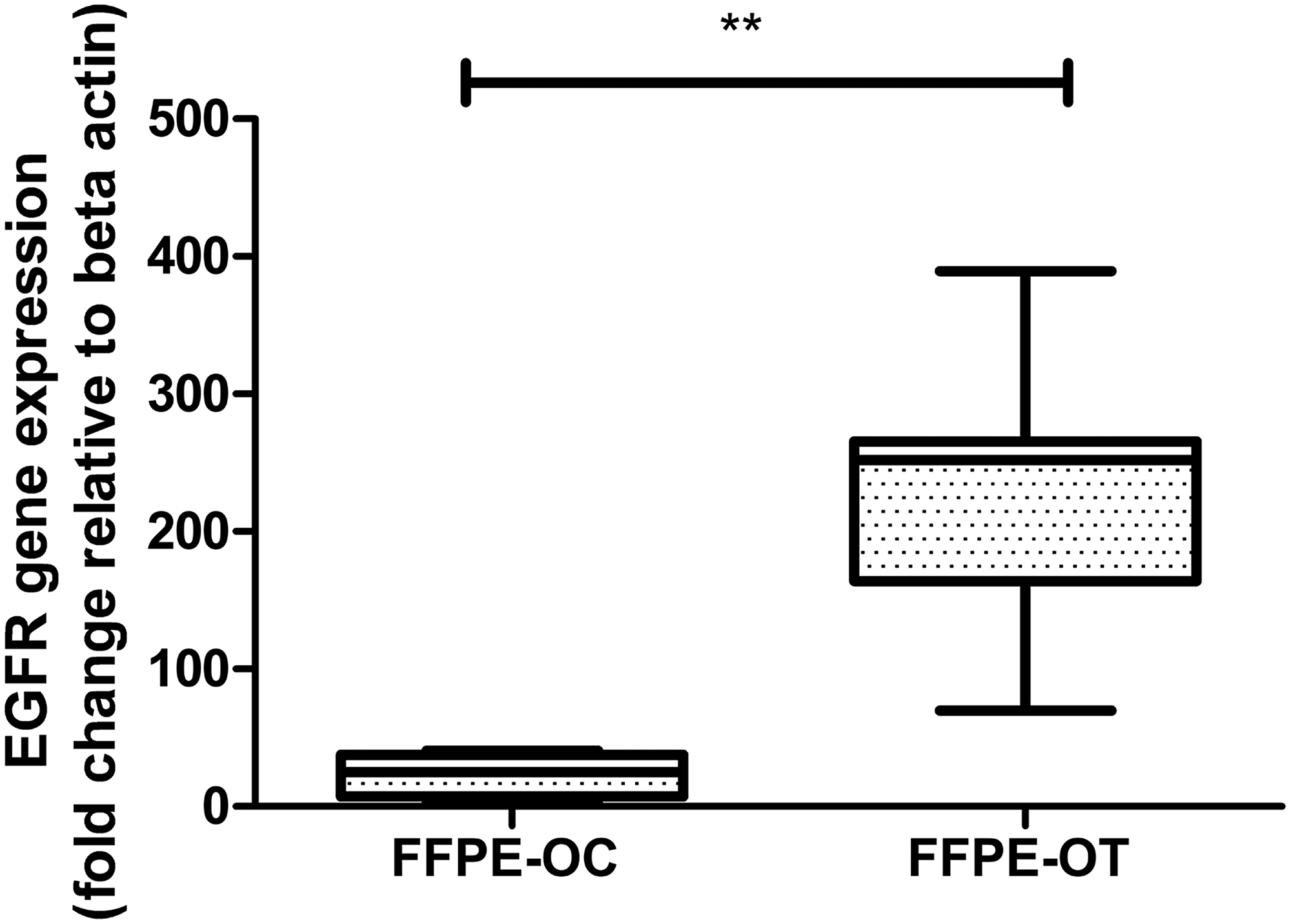 Real-time PCR based validation of EGFR expression in 12 histopathologically characterized FFPE keratinized OSCC by comparison to 5 OC samples using β-actin as an endogenous control.