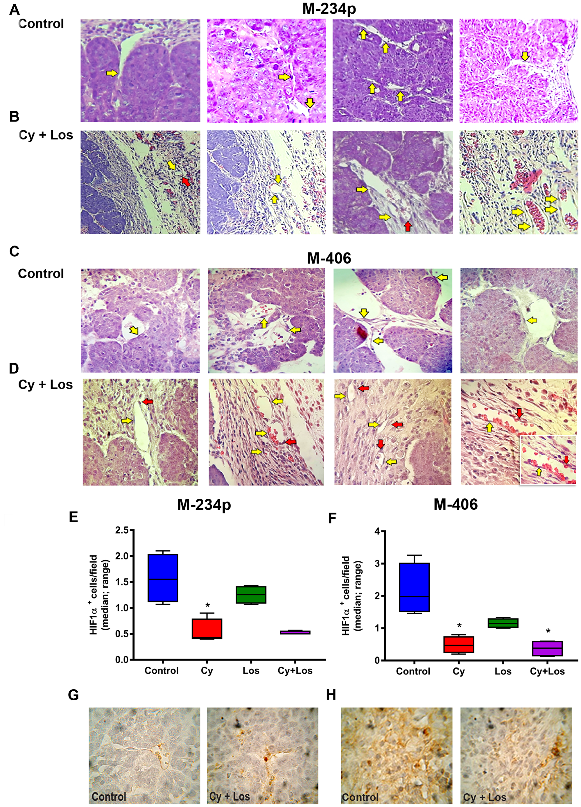 Vascular normalization