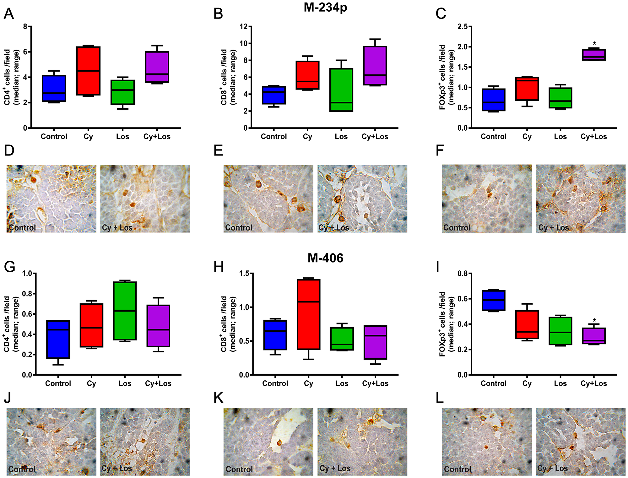 Quantification of tumor infiltrating lymphocytes by IHC