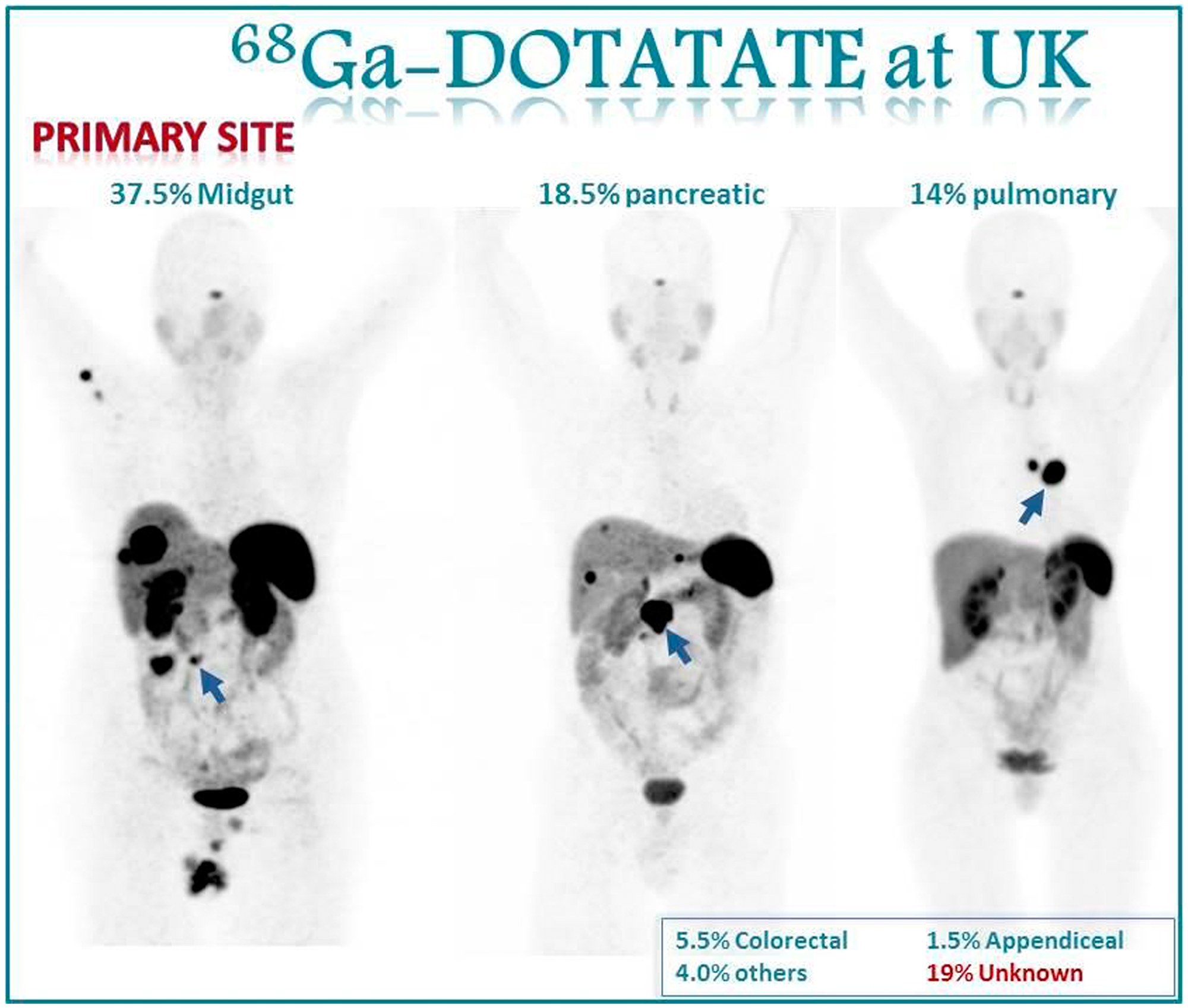 Images show the primary site distribution in our population