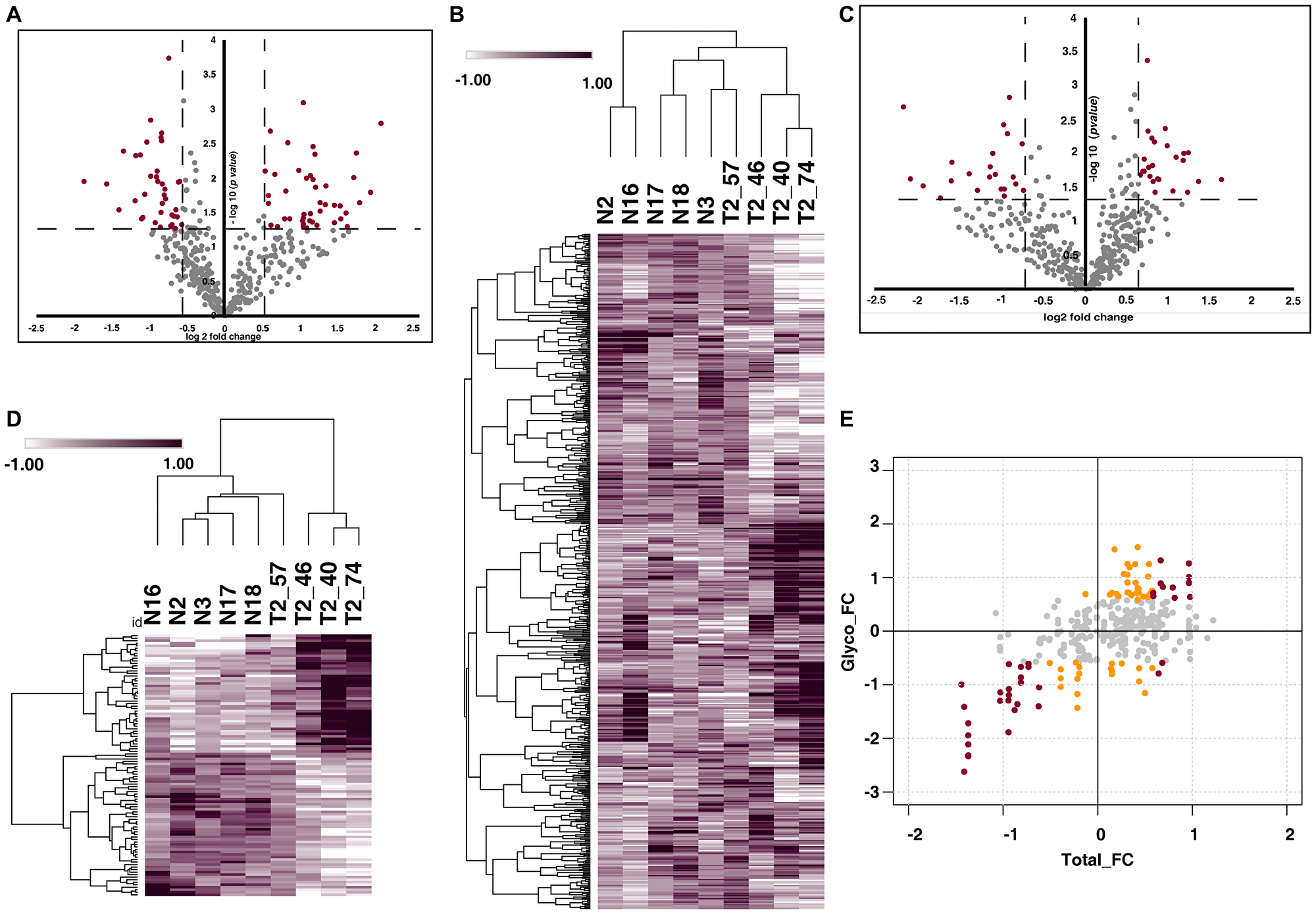 Urinary N-glycoproteome and proteome of MIBC