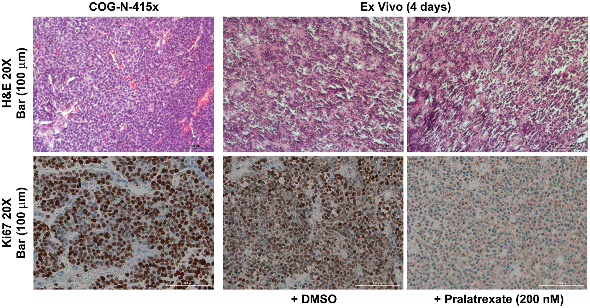Ex vivo tissue culture model recapitulated antitumor response to pralatrexate
