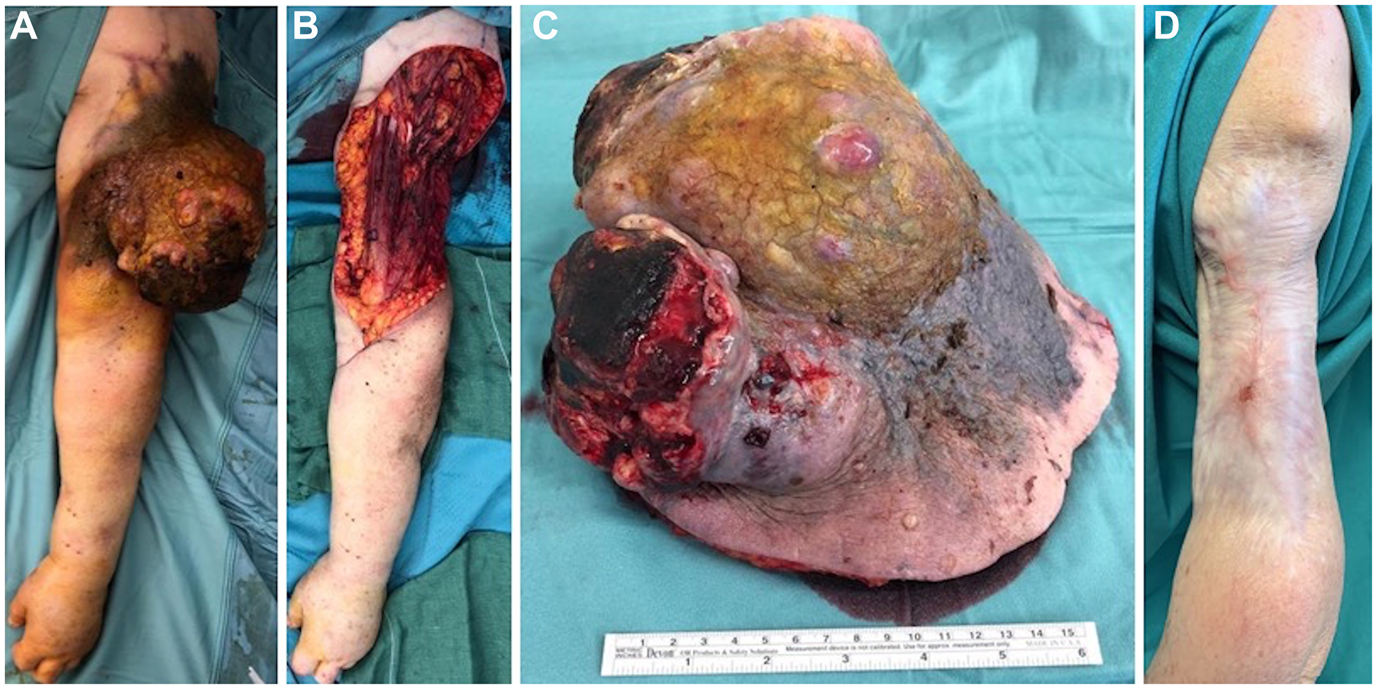 Initial presentation, surgical procedure and postoperative outcome