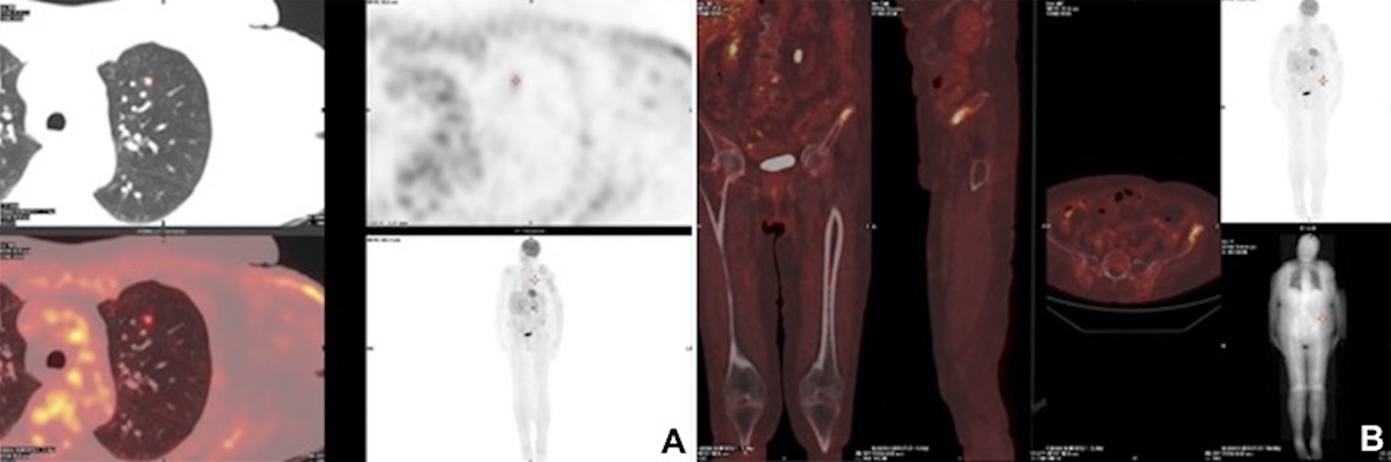 Postoperative radiological images