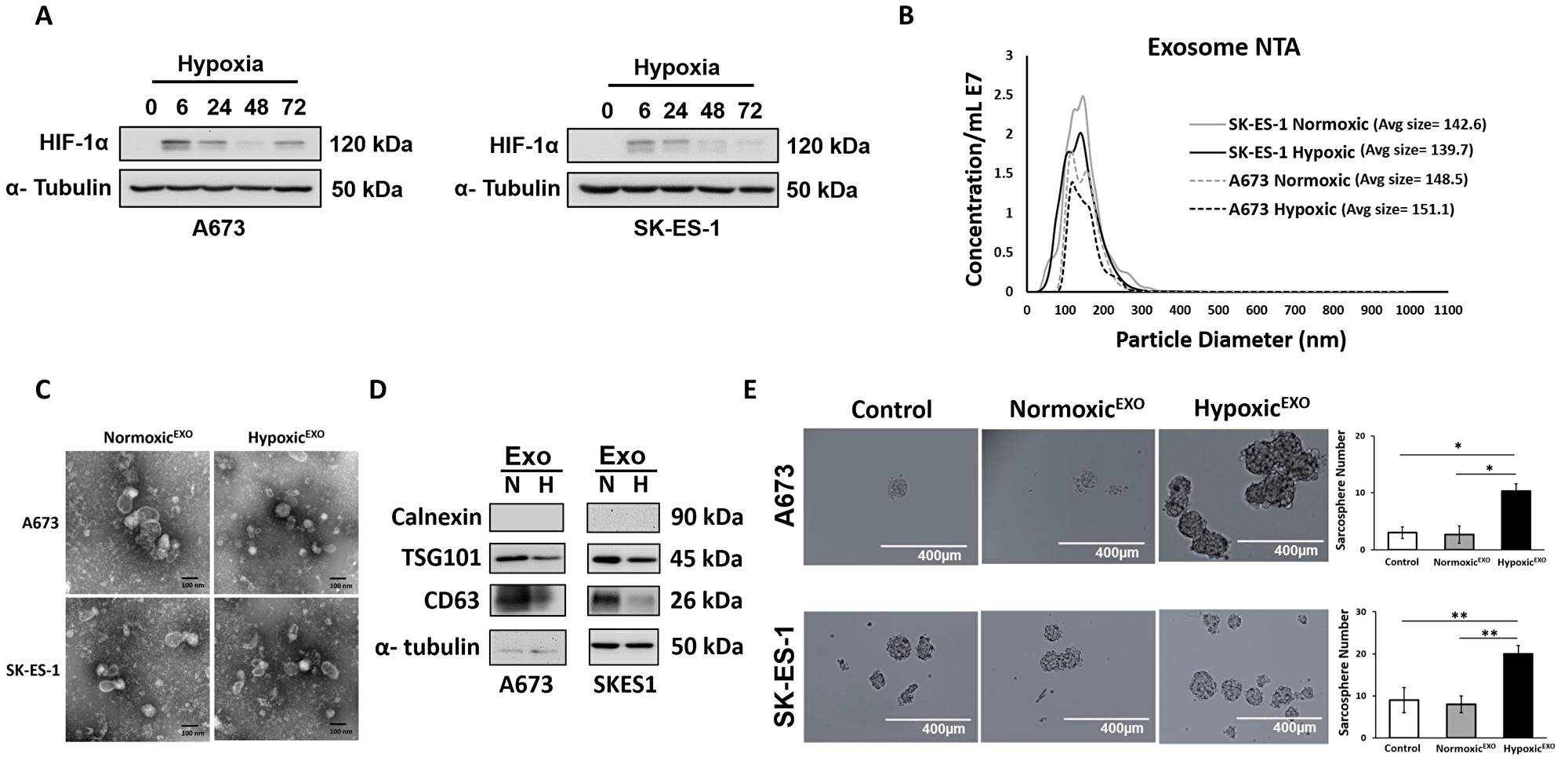 HypoxicEXO enhance sphere formation in EWS cells