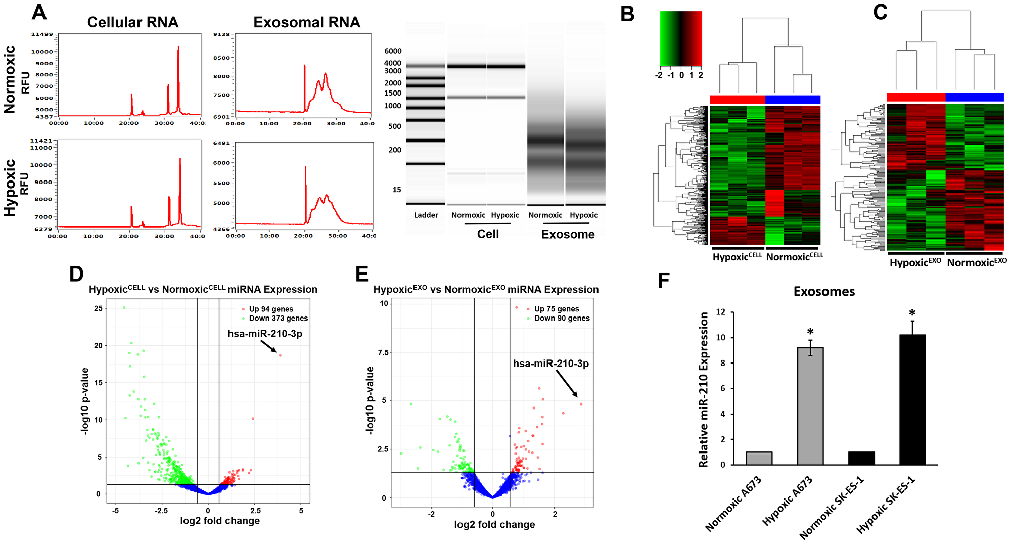 EWS HypoxicEXO carry specific hypoxia regulated miRNA