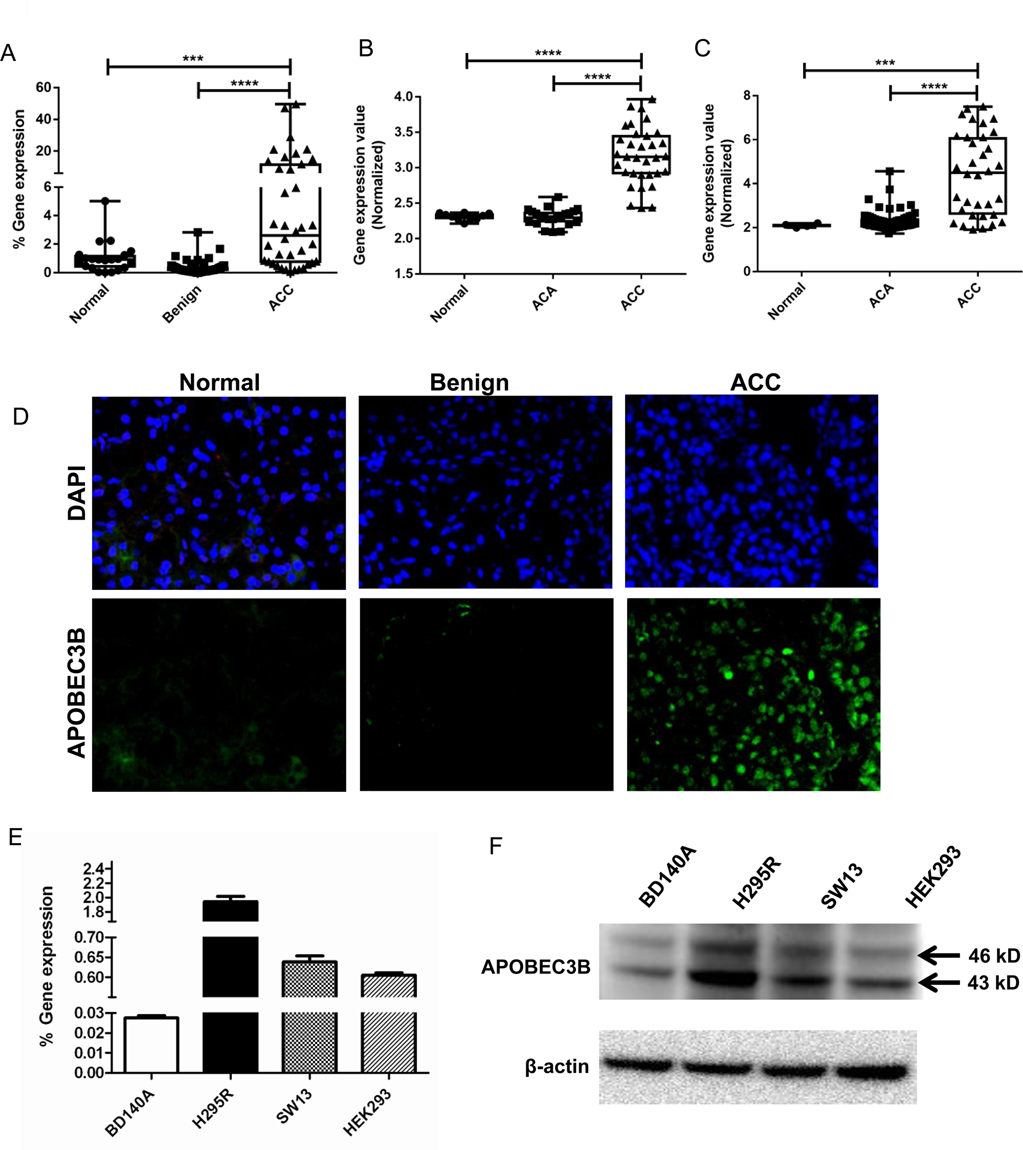APOBEC3B expression in adrenocortical carcinoma