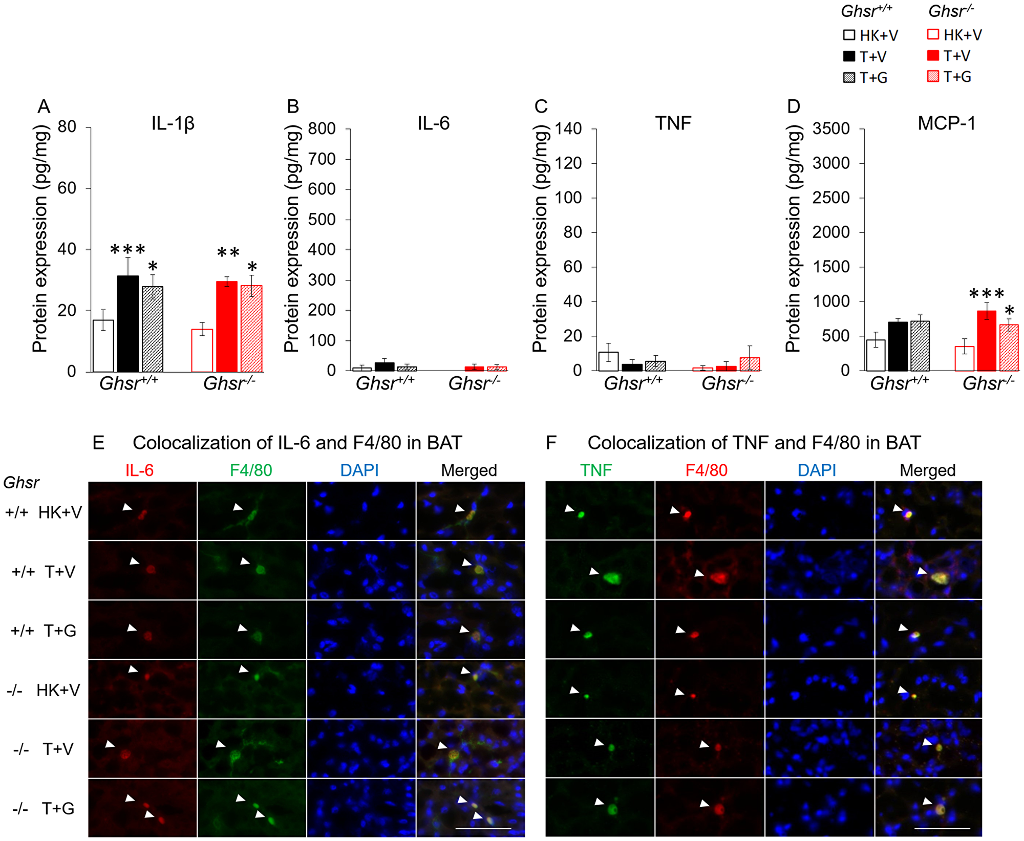 Effects of ghrelin on LLC-induced changes in inflammation and macrophages in BAT