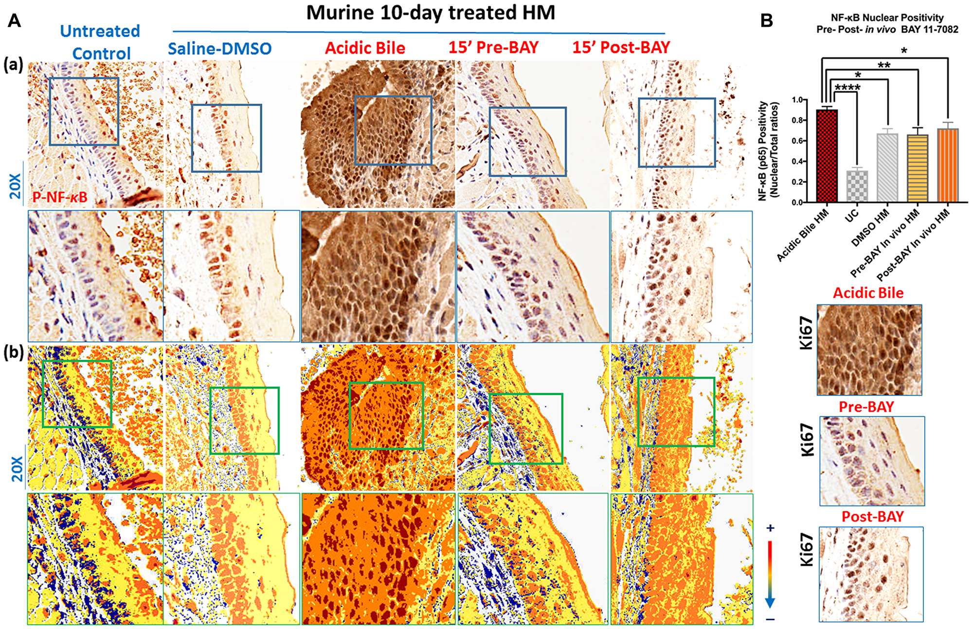 In vivo topical pre- or post-application of BAY 11-7082 inhibits the acidic bile-induced NF-κB activation in 10-days exposed murine HM