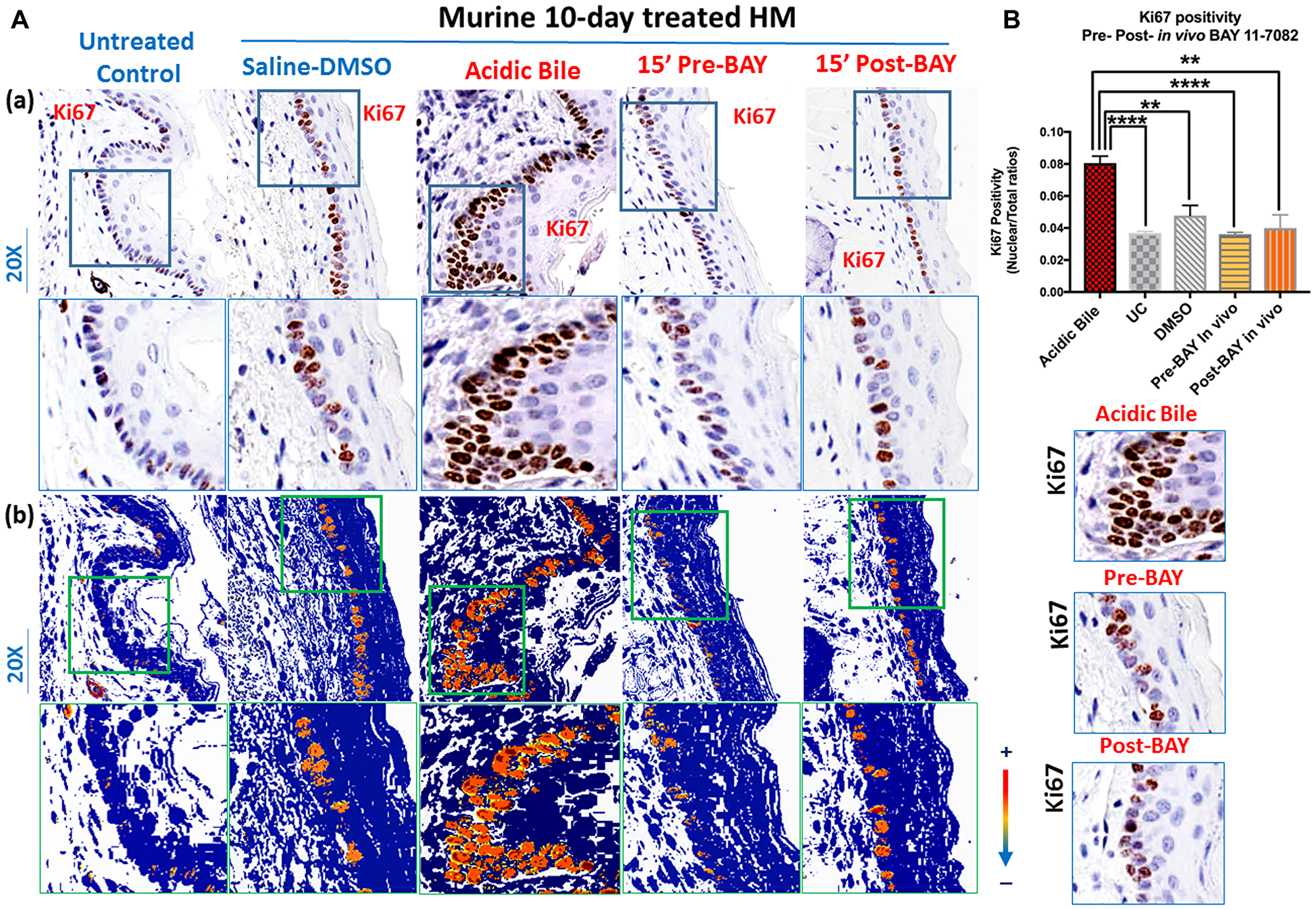 In vivo topical pre- or post-application of BAY 11-7082 prevents acidic bile-induced cell proliferation markerKi67 in 10-day exposed murine HM