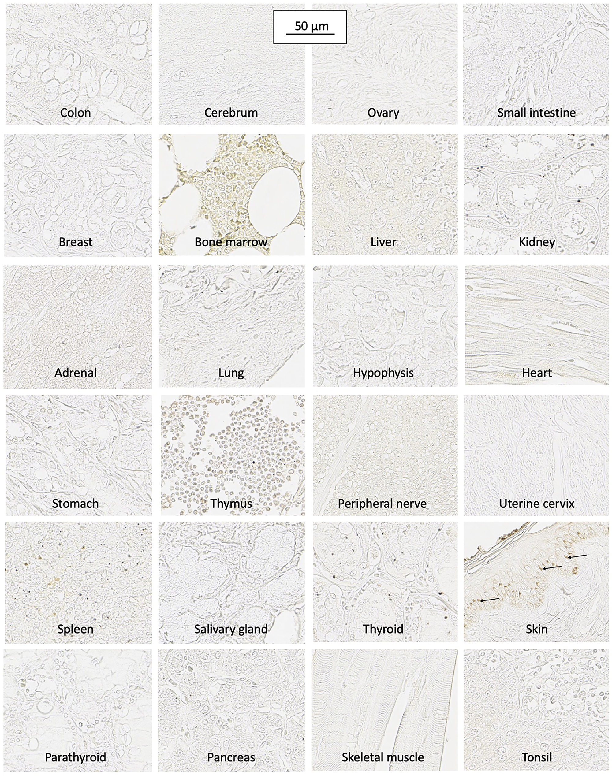 SH7129 binding to normal tissue