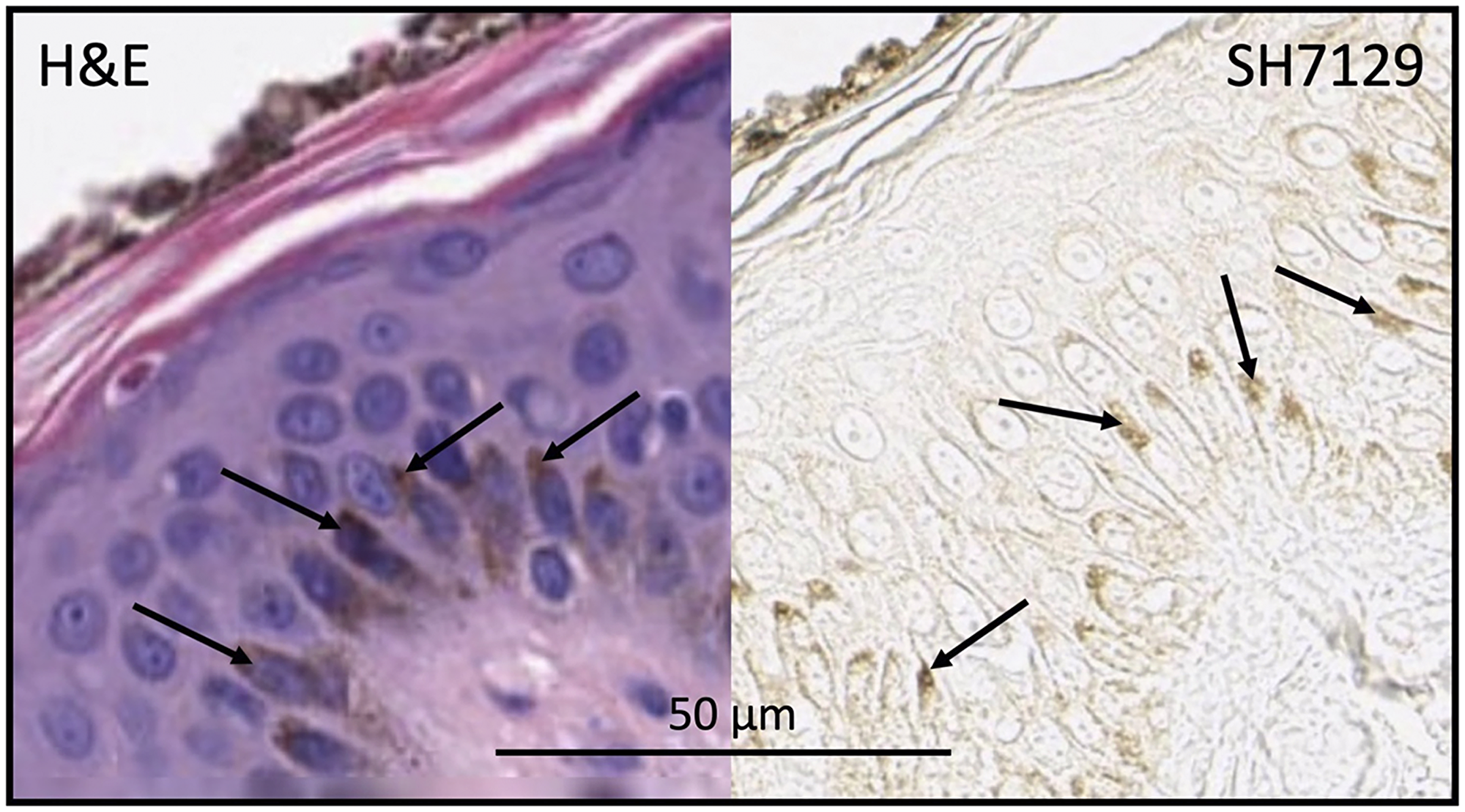 Skin section stained with H&E (without SH7129) or SH7129 (without H&E) showing melanin (arrows) in basal keratinocytes