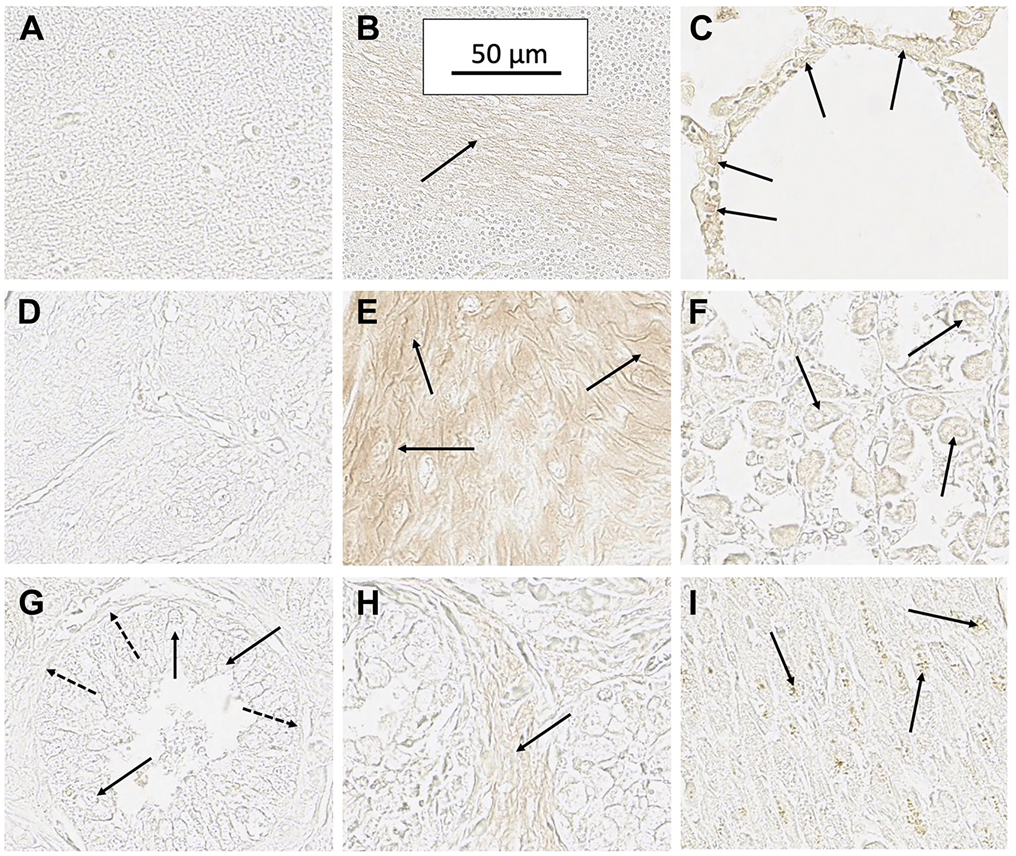 Staining of several normal tissues exhibiting some evidence of SH7129 binding
