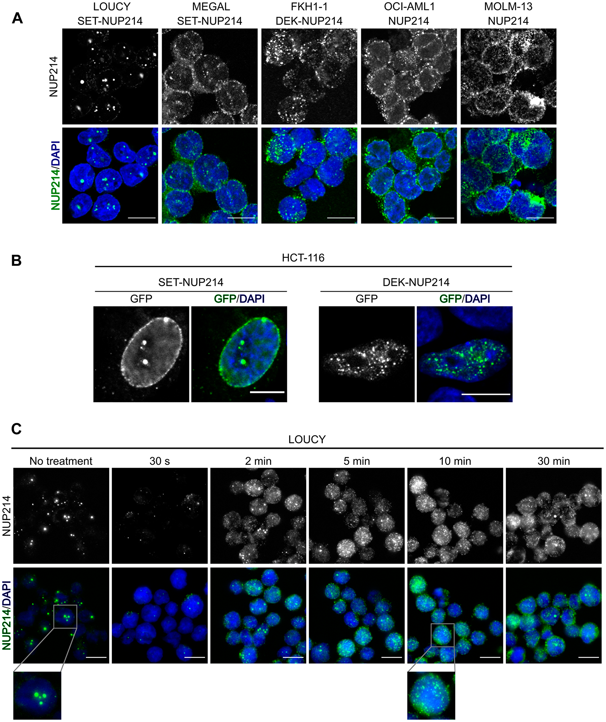NUP214 fusion proteins localize to distinct nuclear bodies