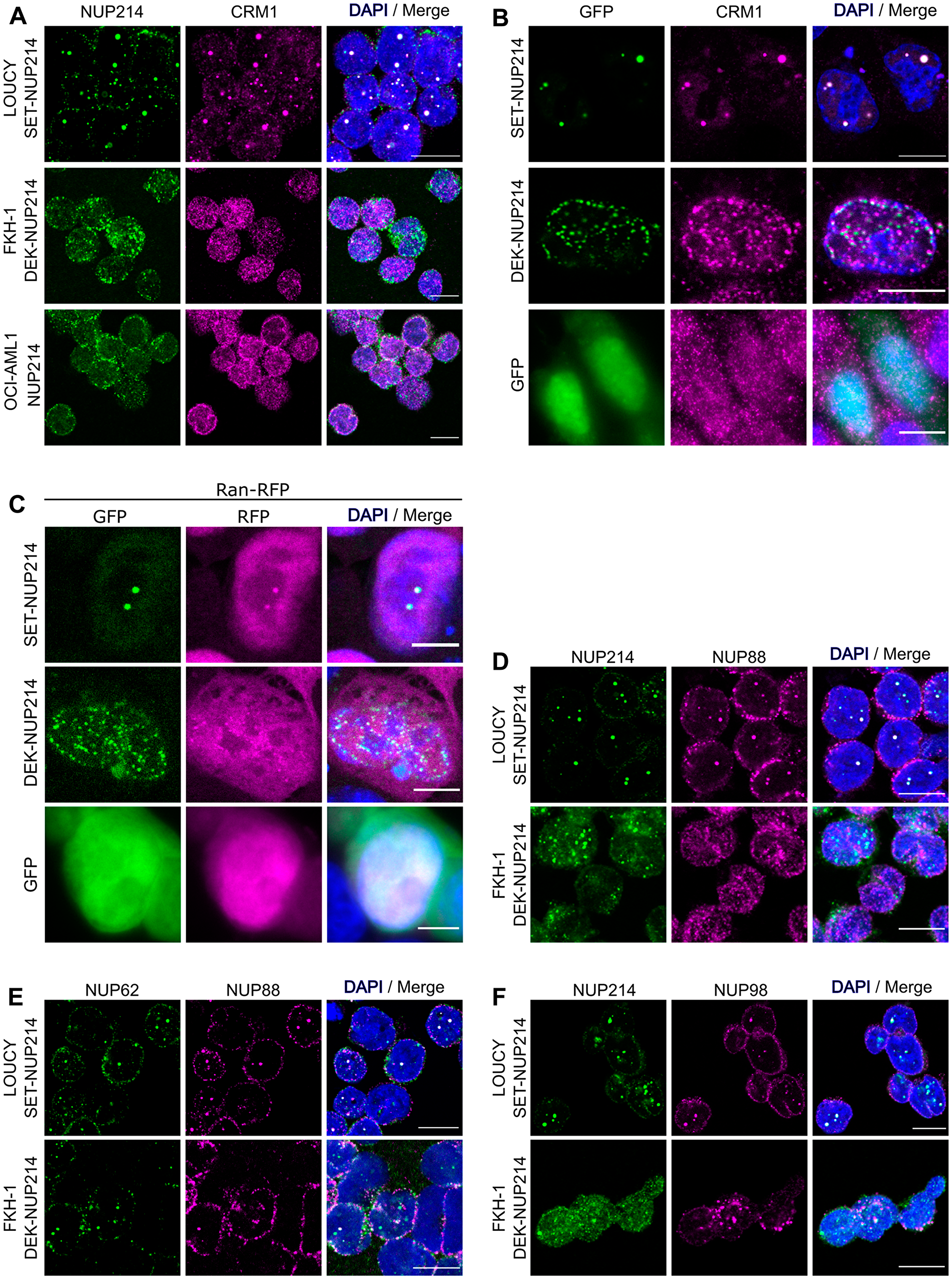 NUP214 fusions sequester the nuclear export factor CRM1 and endogenous nucleoporins to nuclei
